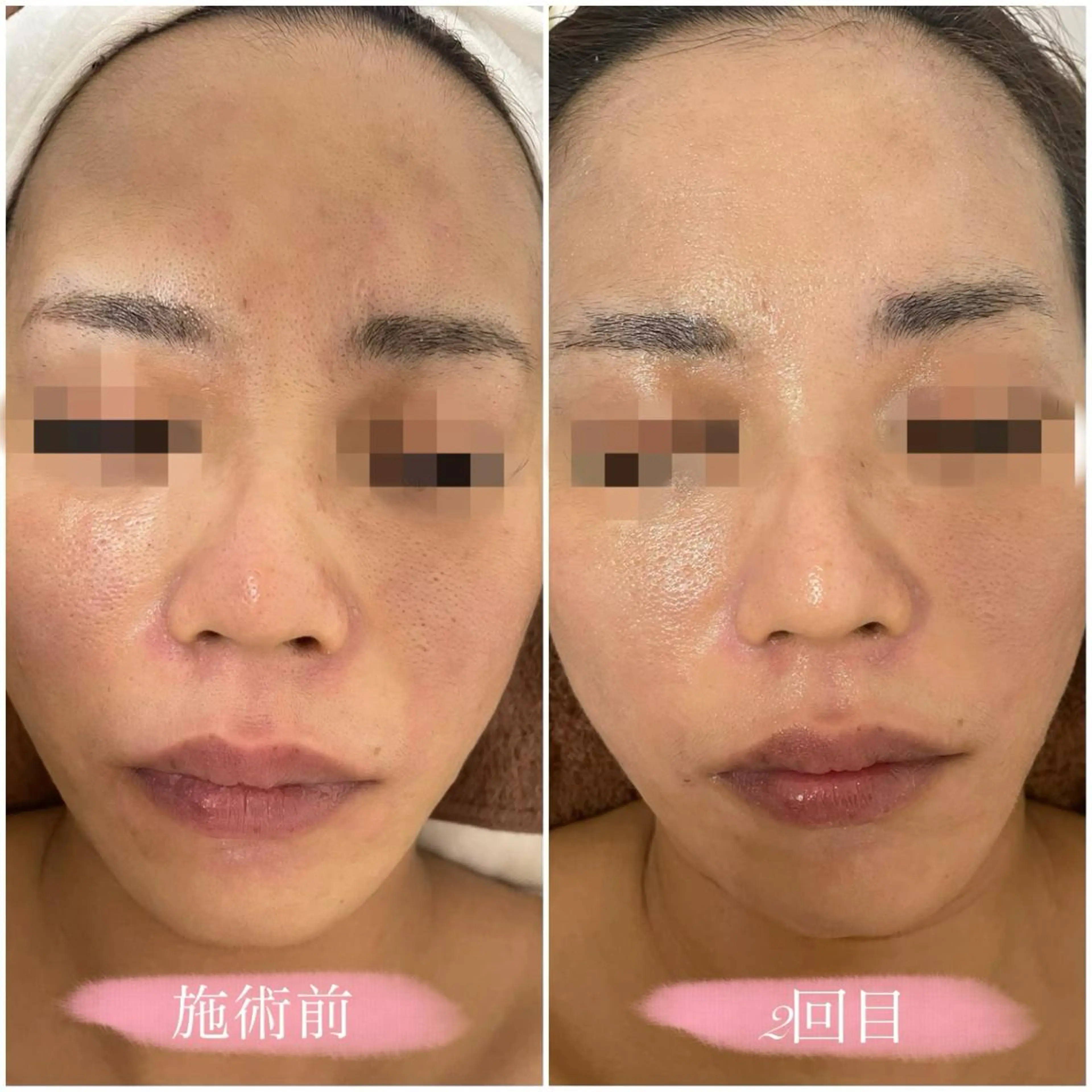 心斎橋　Voyage serein🌙のマツエク・マツパデザイン