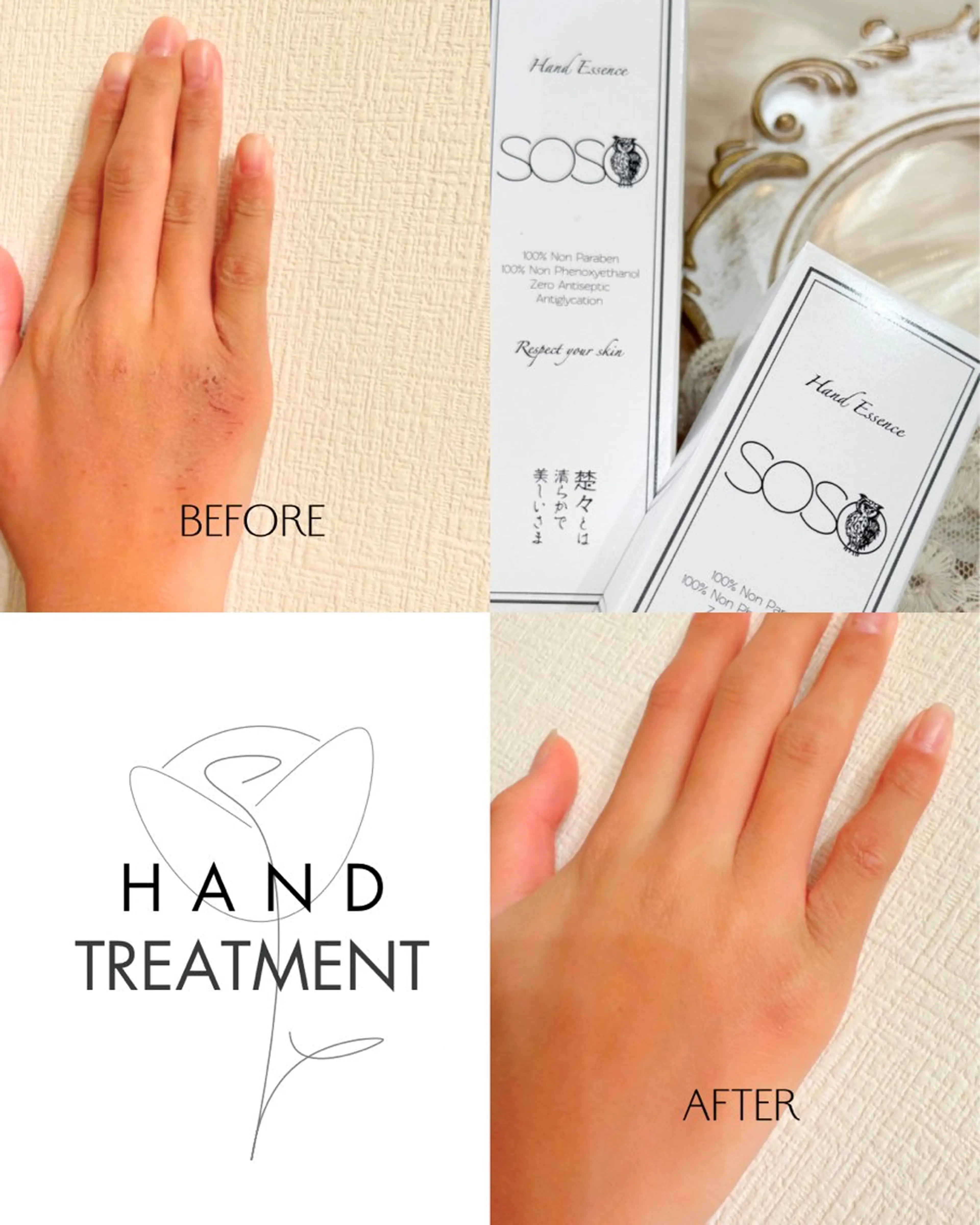 奇跡のハンドトリートメント！一回お試しの写真
