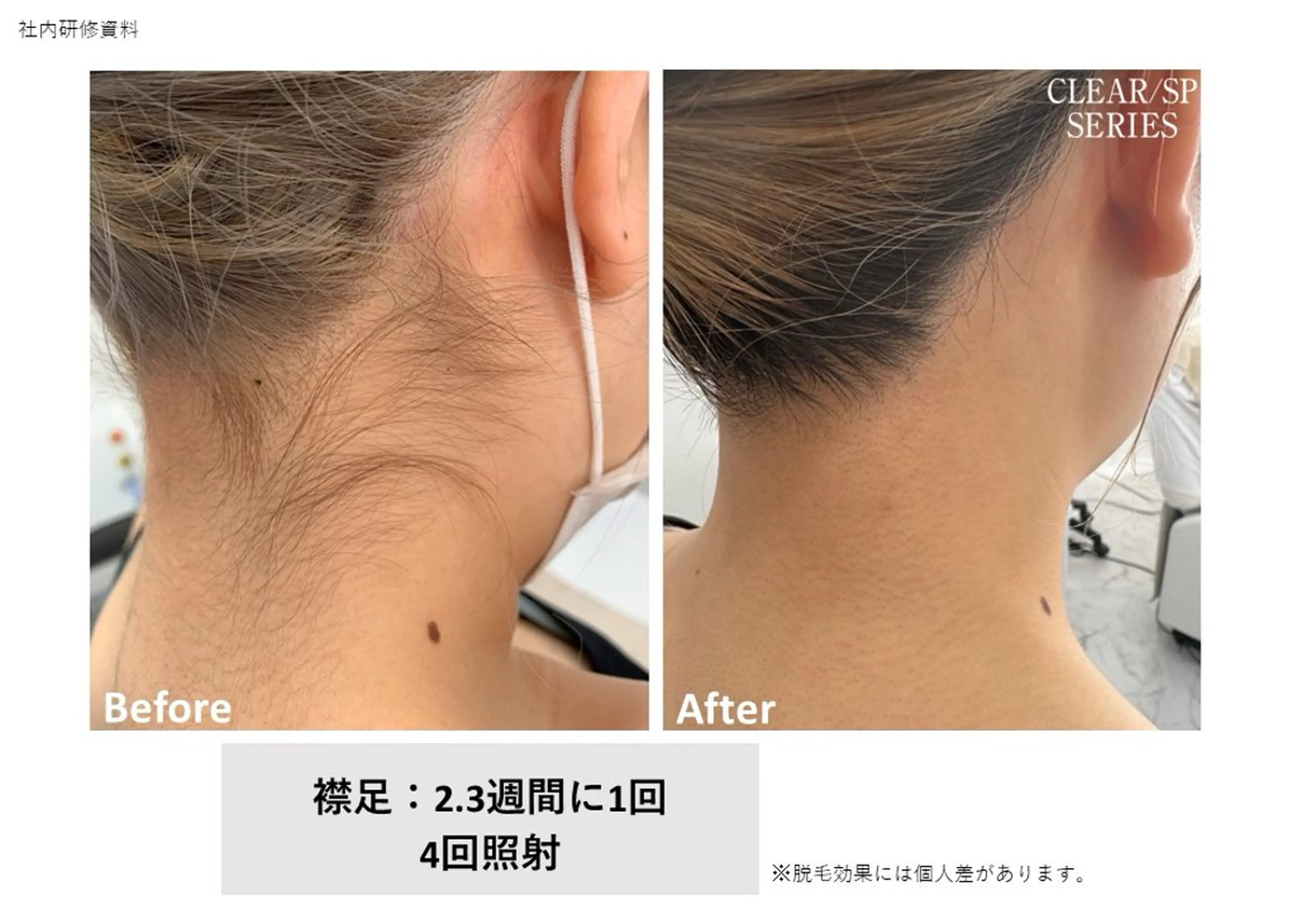 脱毛 Laki wax chikaのエステ・リラクイメージ