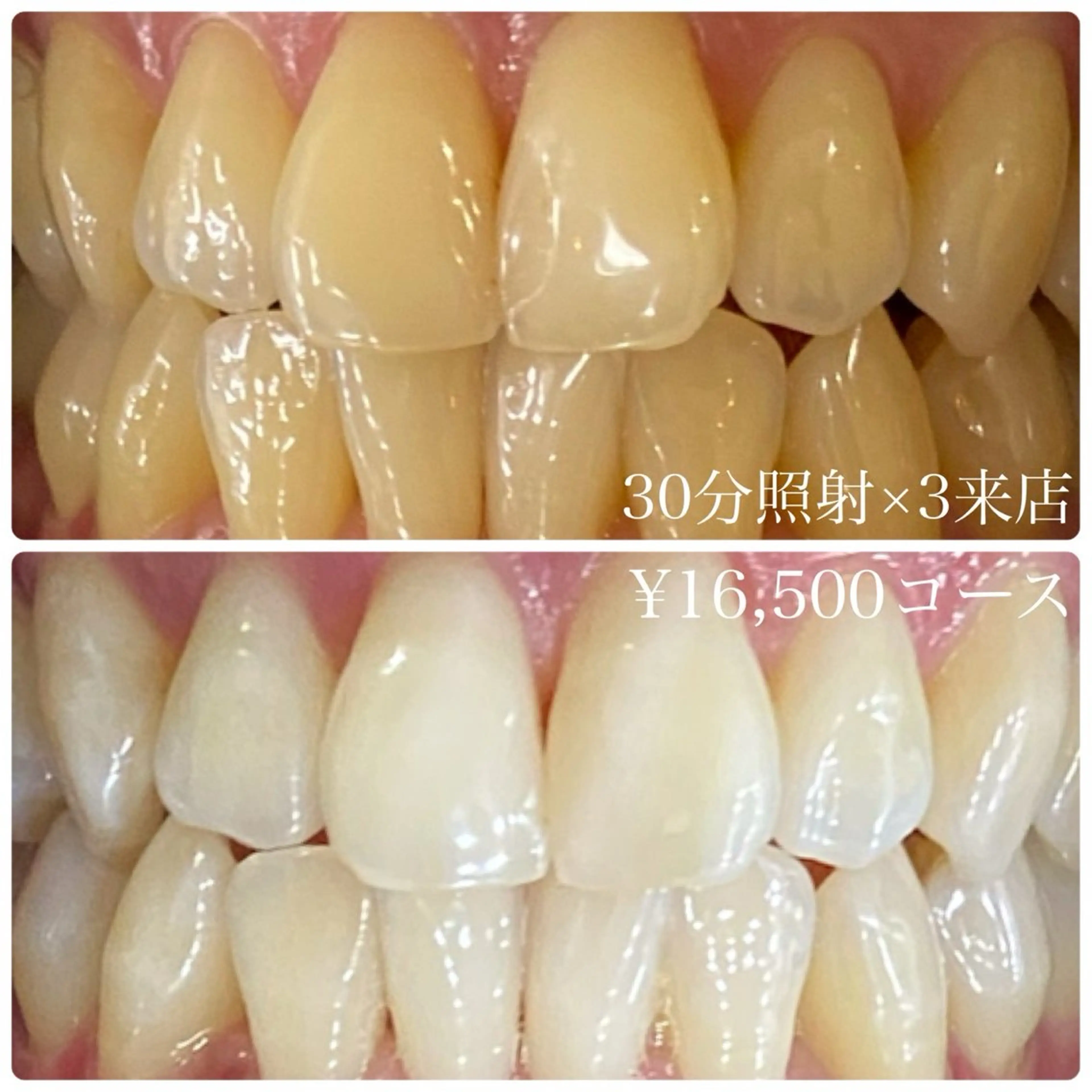 メンズ その他 ホワイトニング ルーム　川崎店のその他イメージ