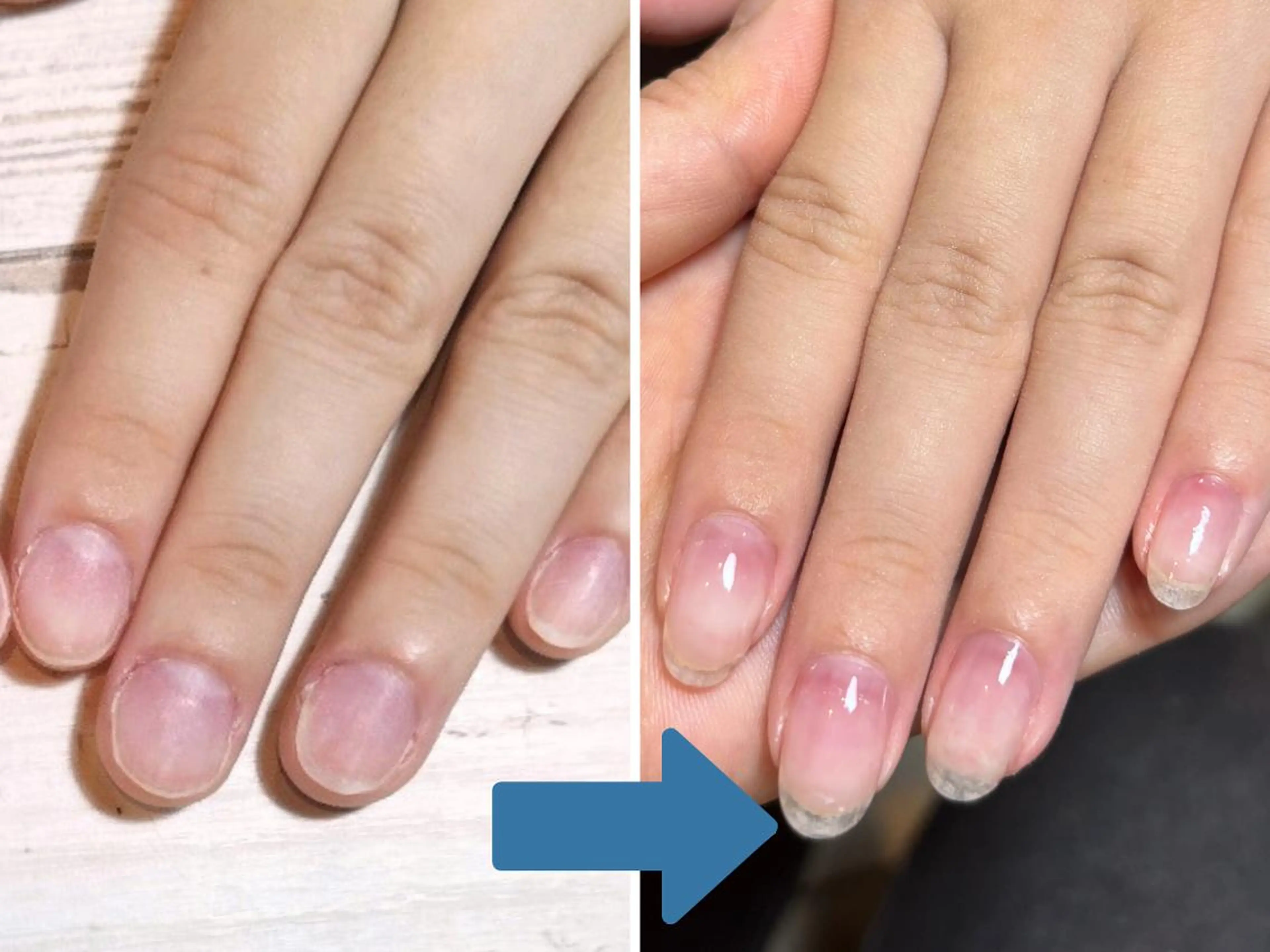 ネイル 深爪矯正・自爪育成 ネイルサロンアモまいのネイルデザイン