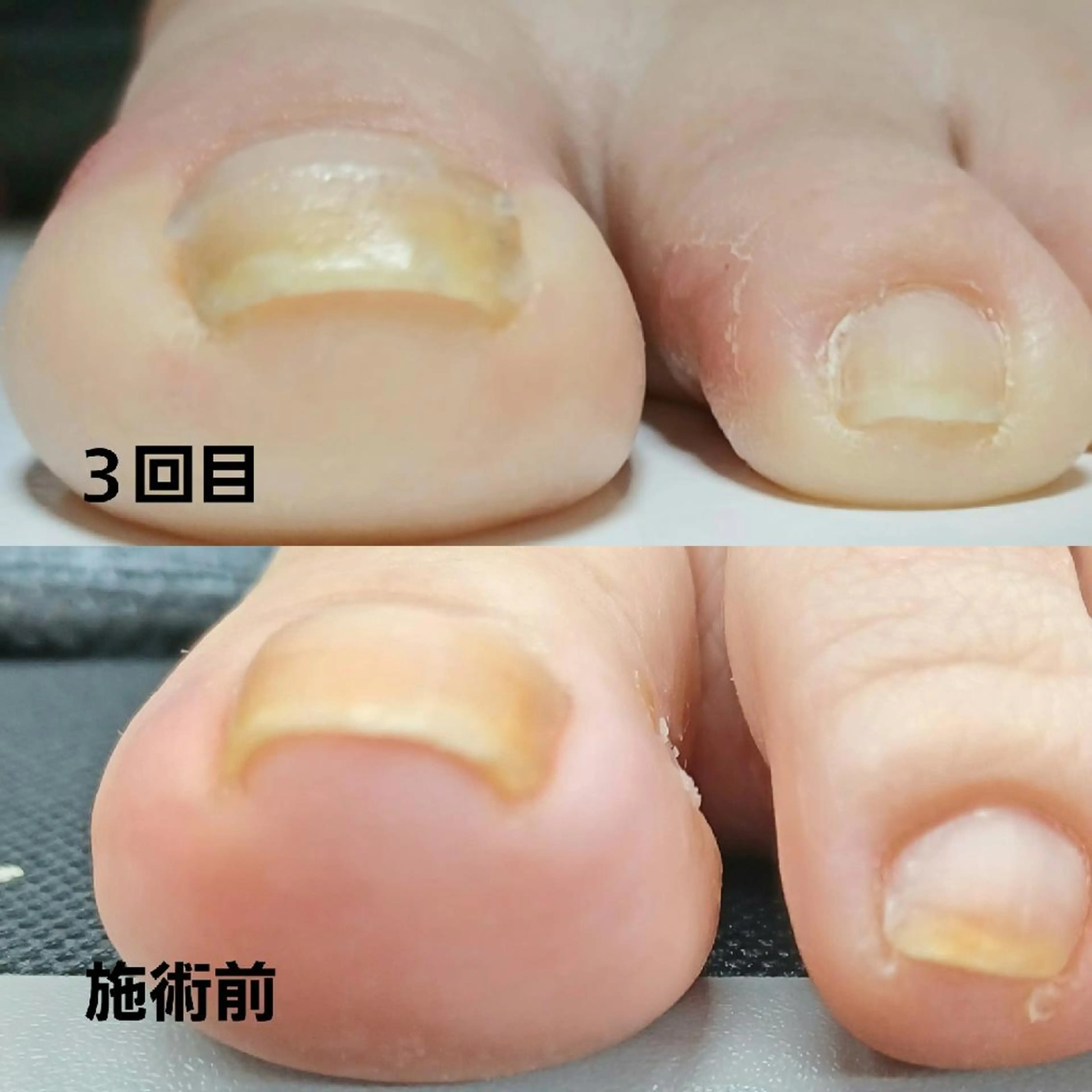 ネイル Micky nail chikushinoのその他イメージ