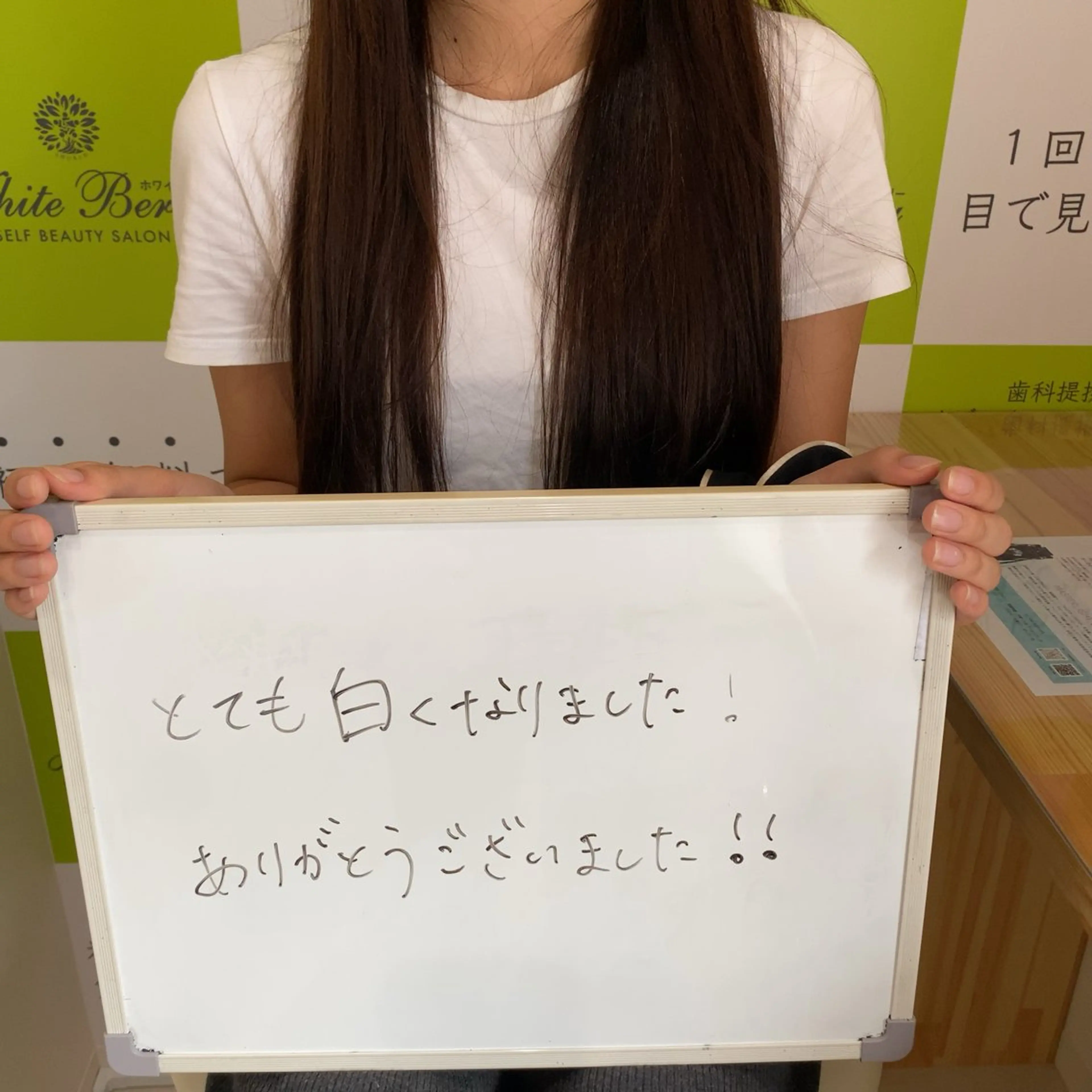 セルフホワイトニング 🦷口元垢抜け✨のその他イメージ
