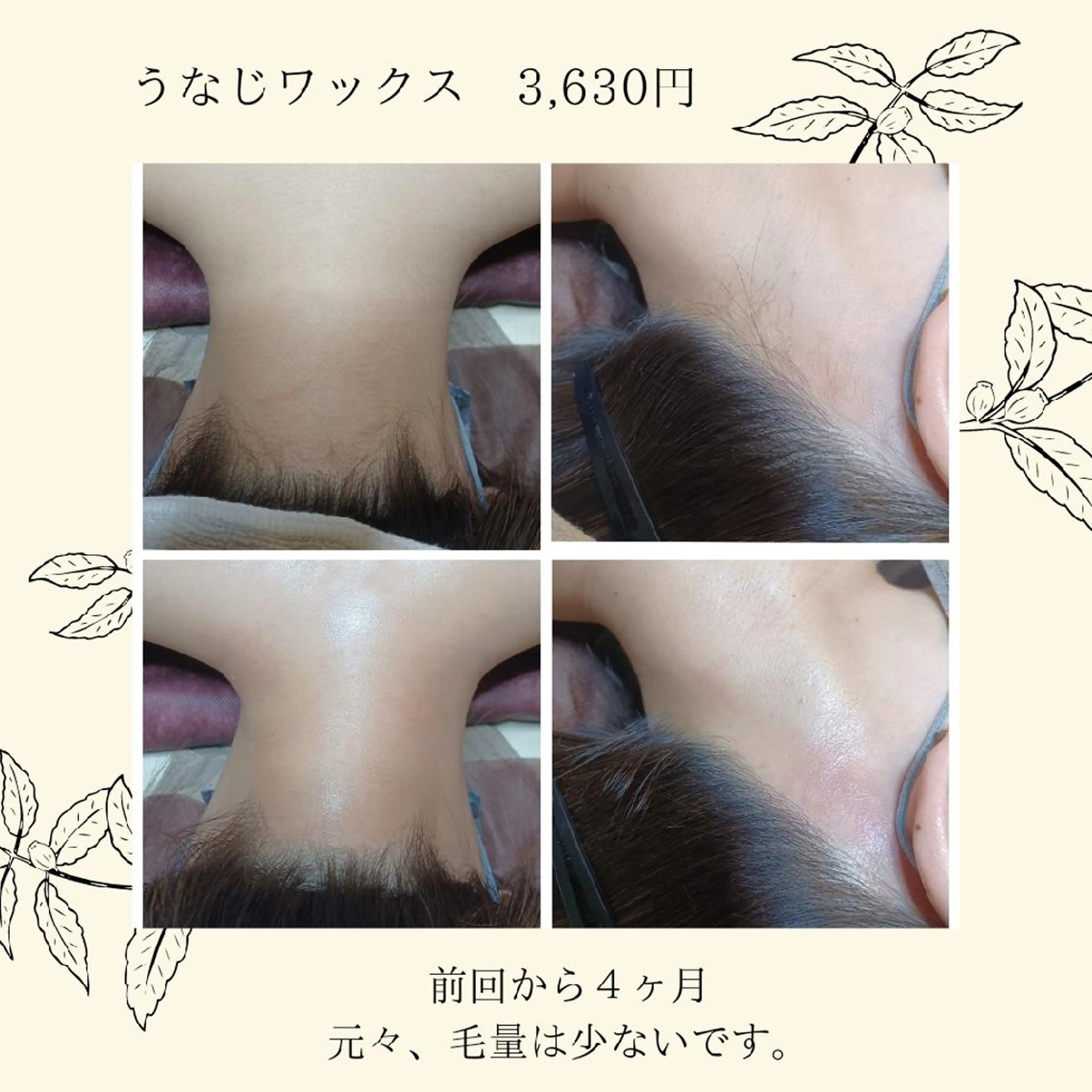 Lutella所属・ワックス脱毛専門店 Lutellaのエステ・リラクイメージ