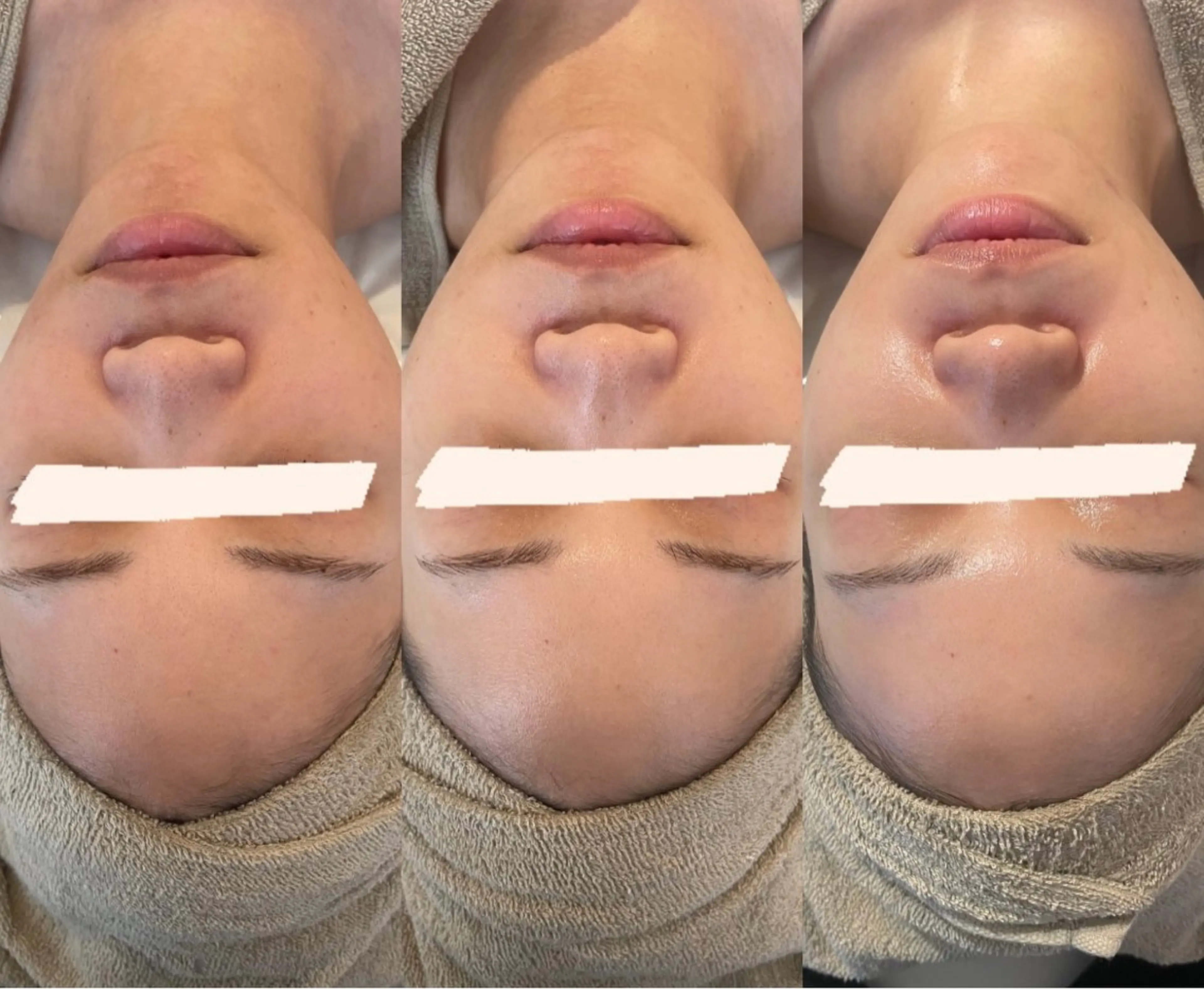 中目黒ハーブピーリン グ🌿ララピールのエステ・リラクイメージ