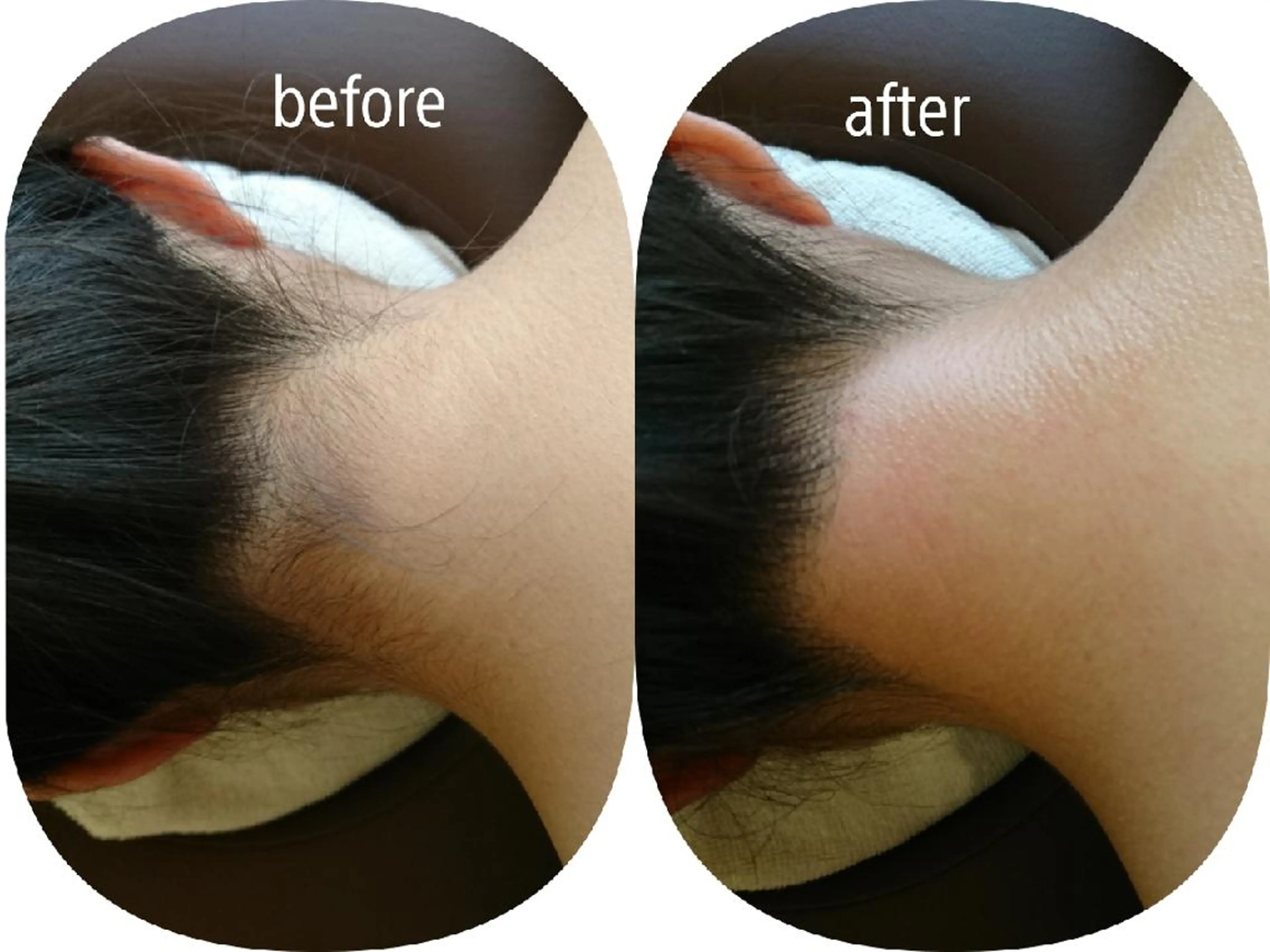 ワックス脱毛専門店 Lutellaのエステ・リラクイメージ