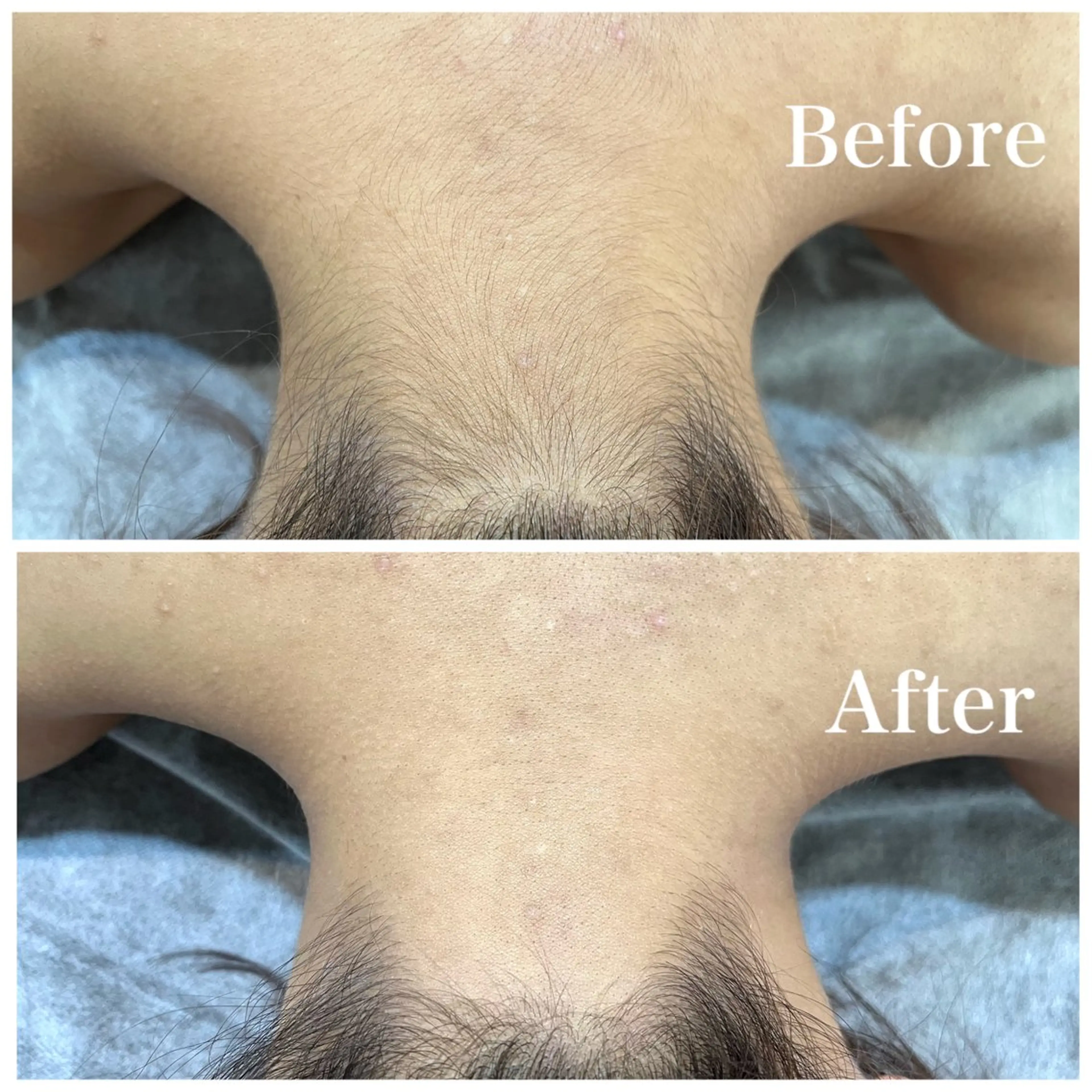 脱毛サロン fam.豊澤柚良のエステ・リラクイメージ