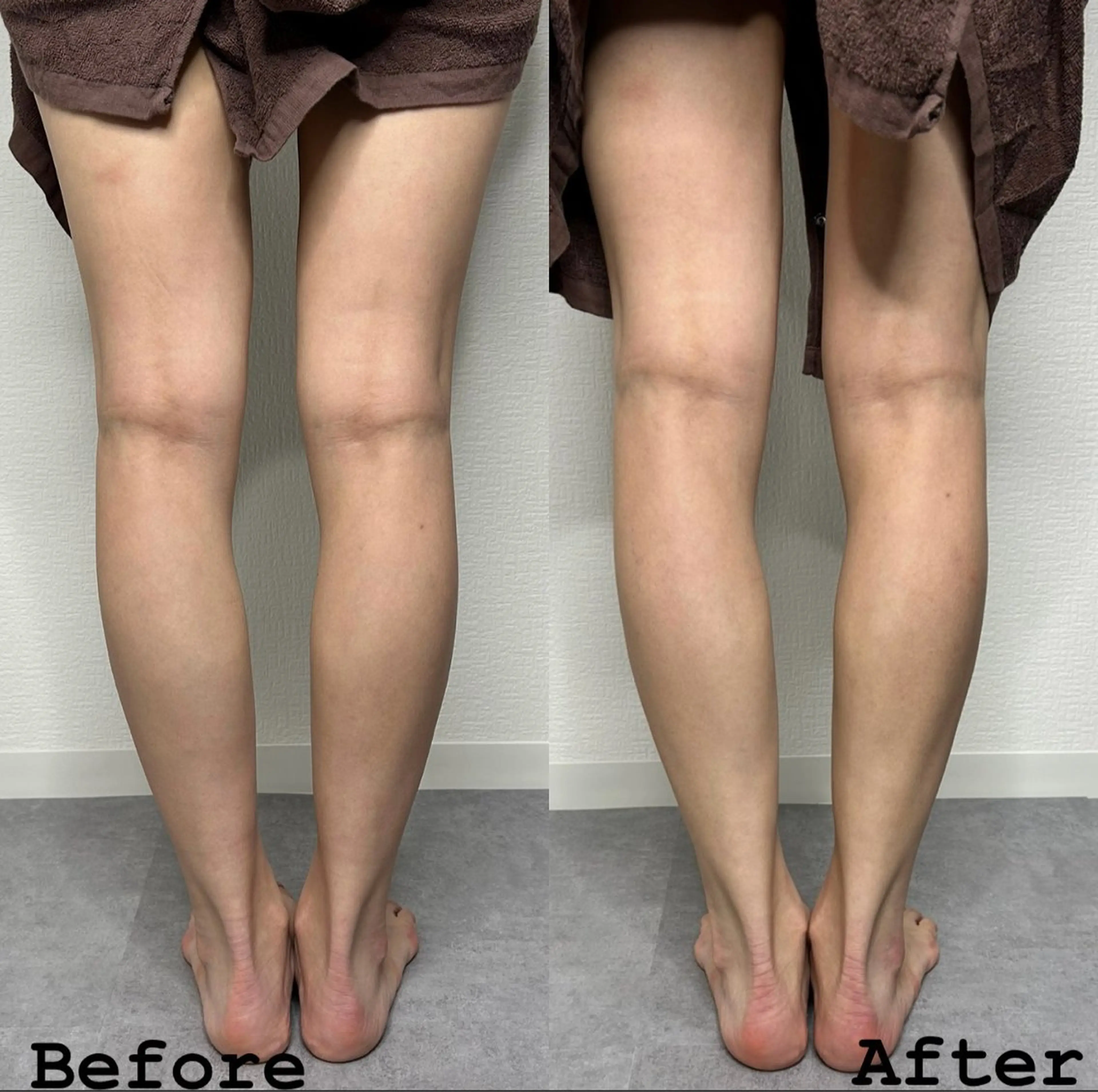 SOIN ボディー リラクゼーションのエステ・リラクイメージ