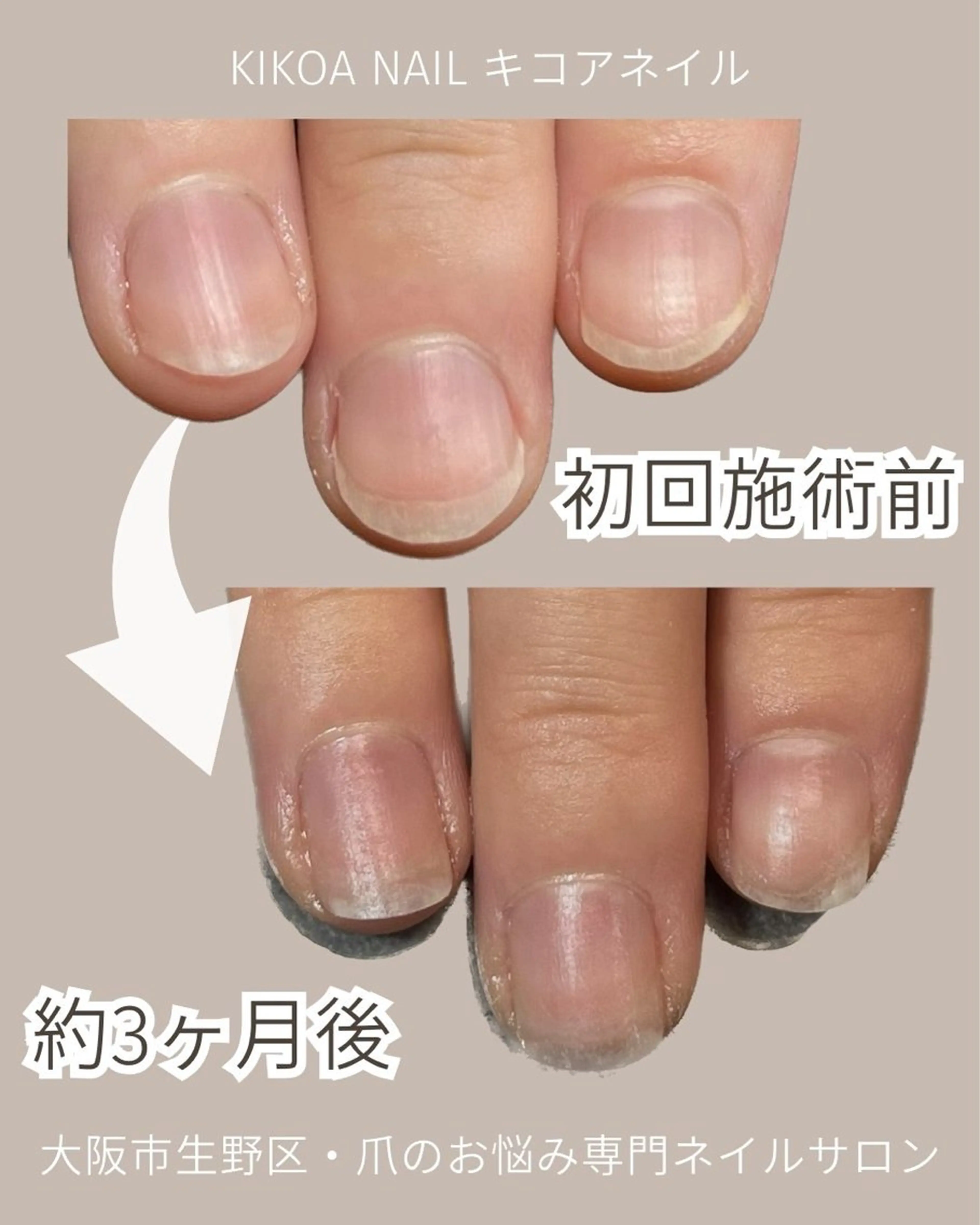 ネイル KIKOA NAIL キコアネイルのネイルデザイン
