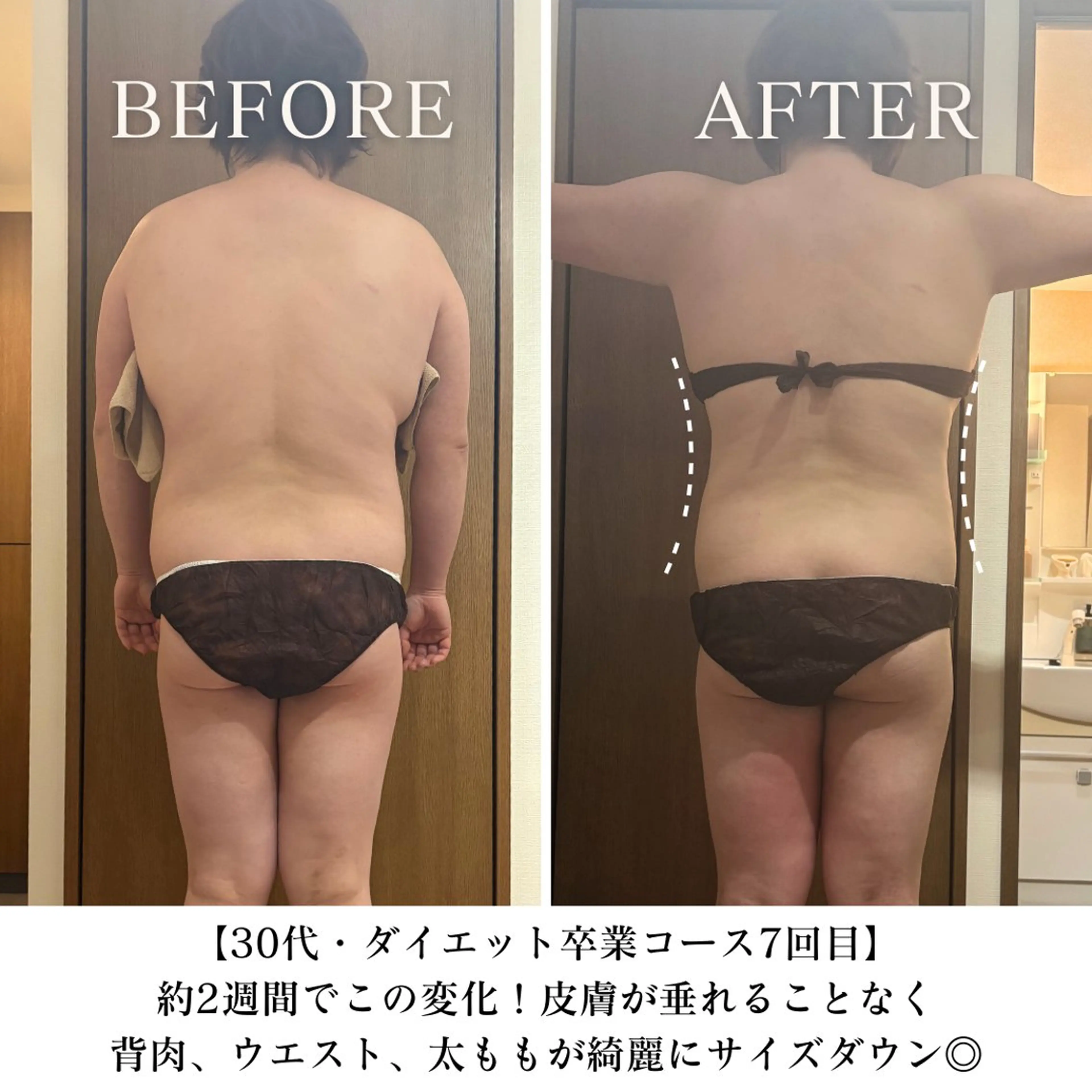 【目黒】本格痩身✴︎ 最新型よもぎ蒸しのエステ・リラクイメージ