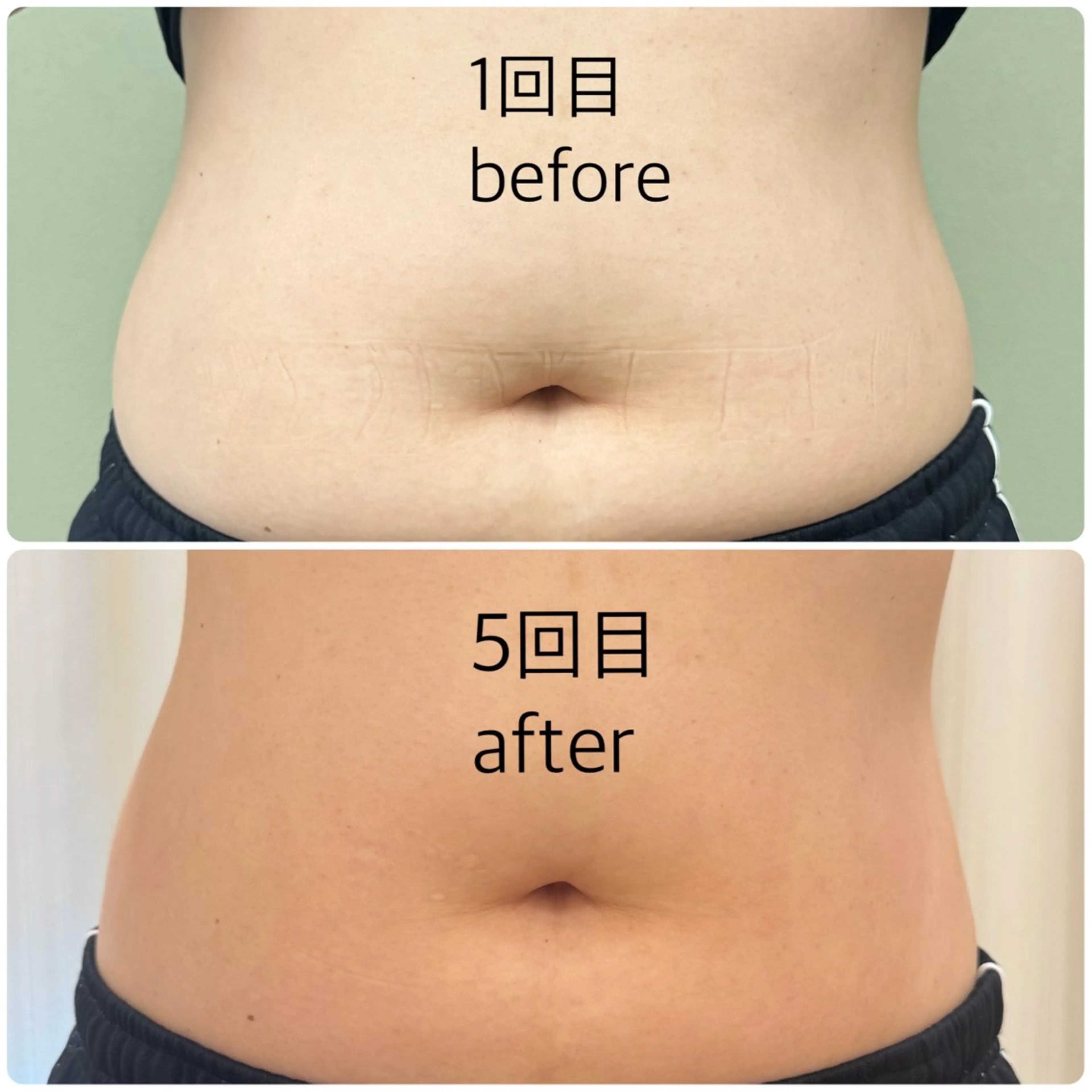 ほねつぎ一休さん 宇品店のエステ・リラクイメージ