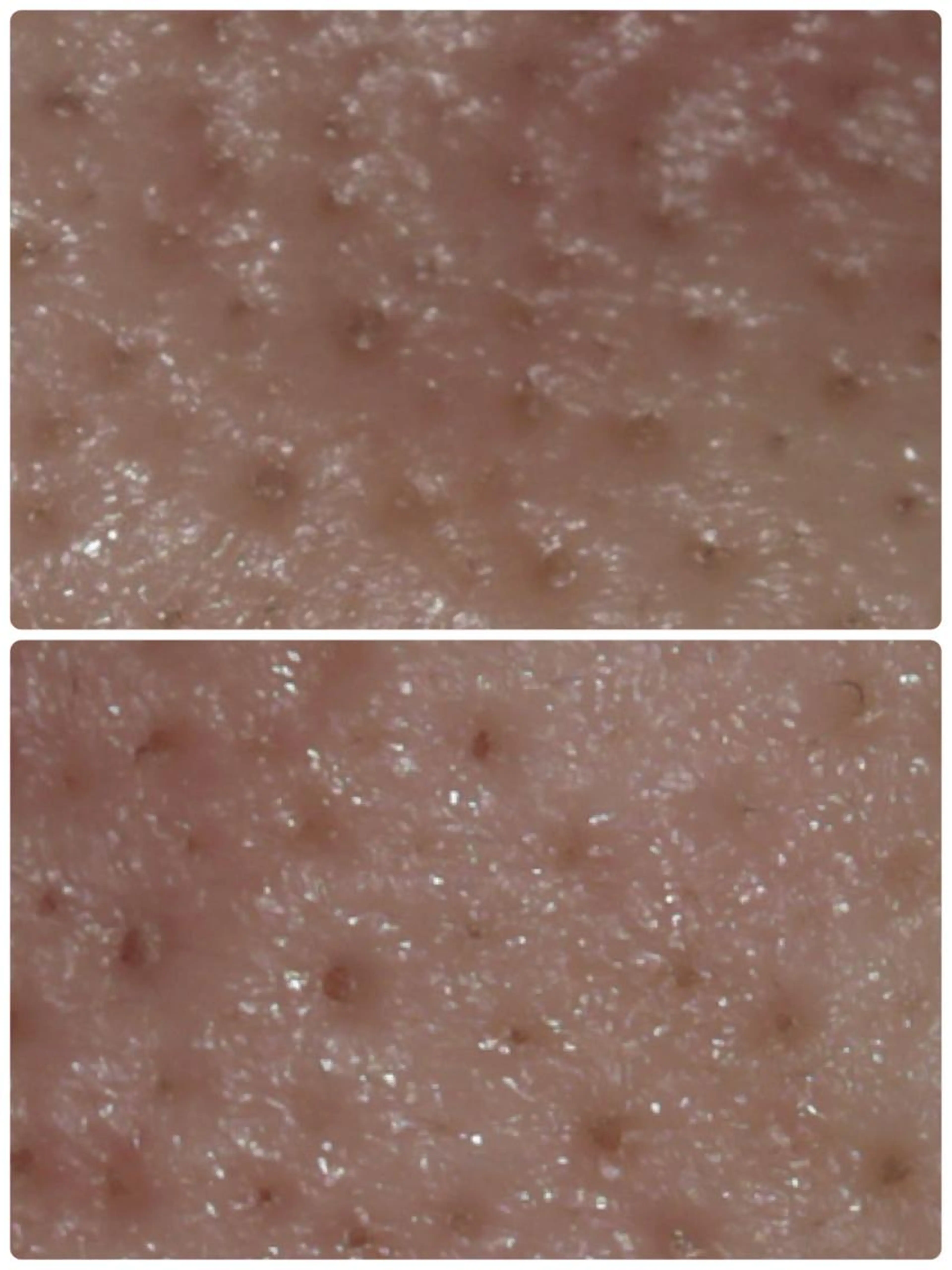 毛穴のつまりやザラつきが気になる方へ《超音波洗浄付フェイシャル​〜​デコルテケア》60分（メンズ可）の写真