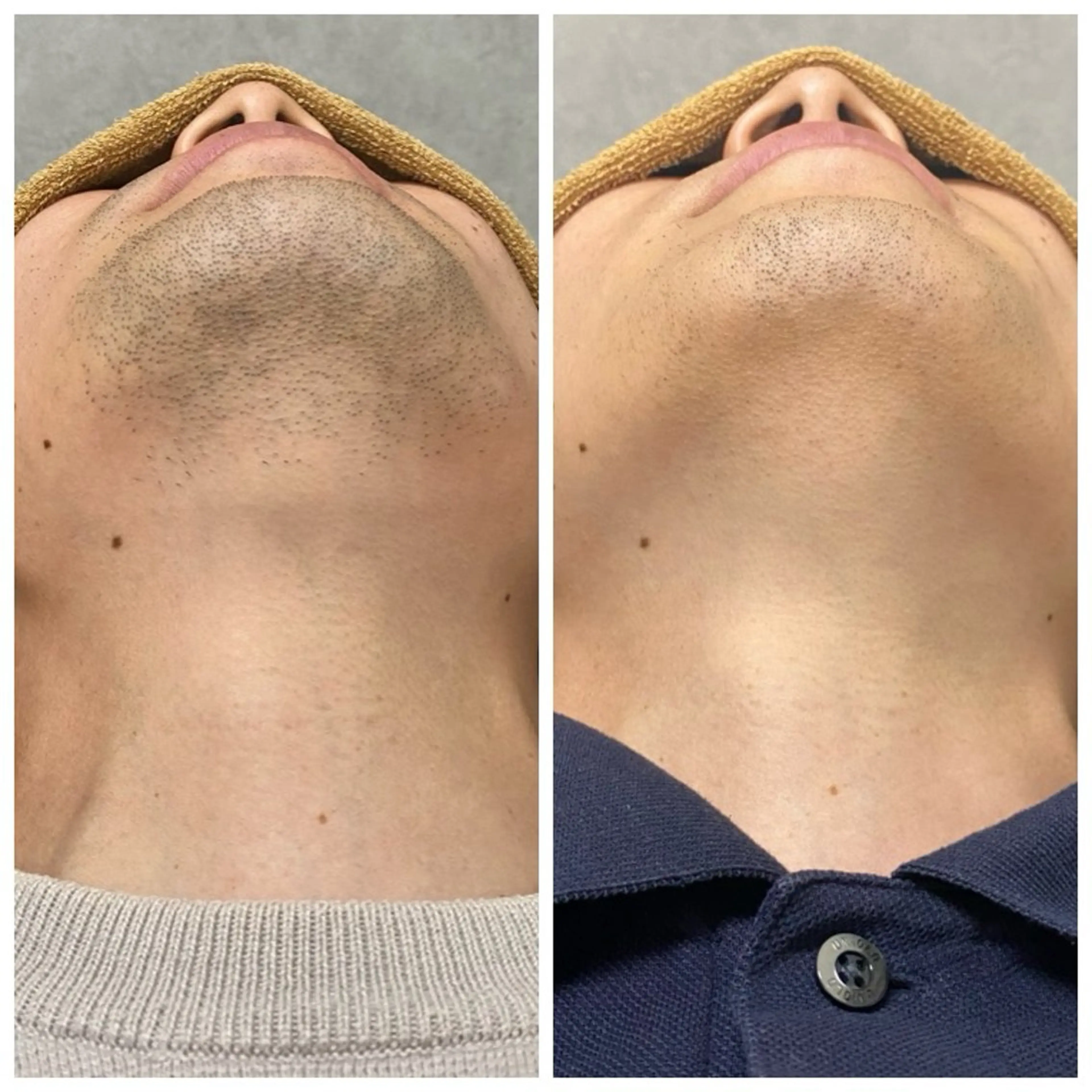 メンズ いしざわ /メンズ脱毛サロンのエステ・リラクイメージ