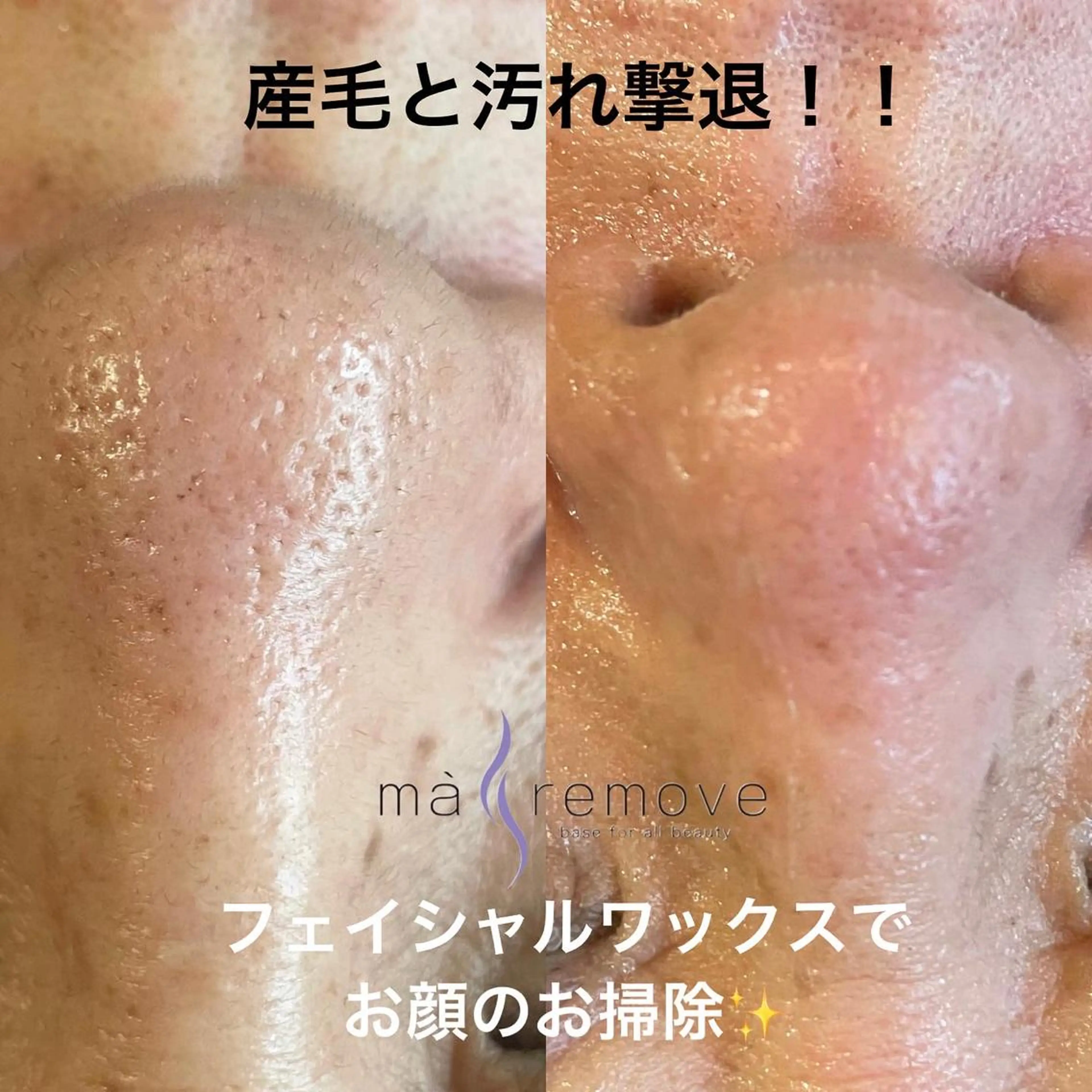 amu nail. RINAのネイルデザイン