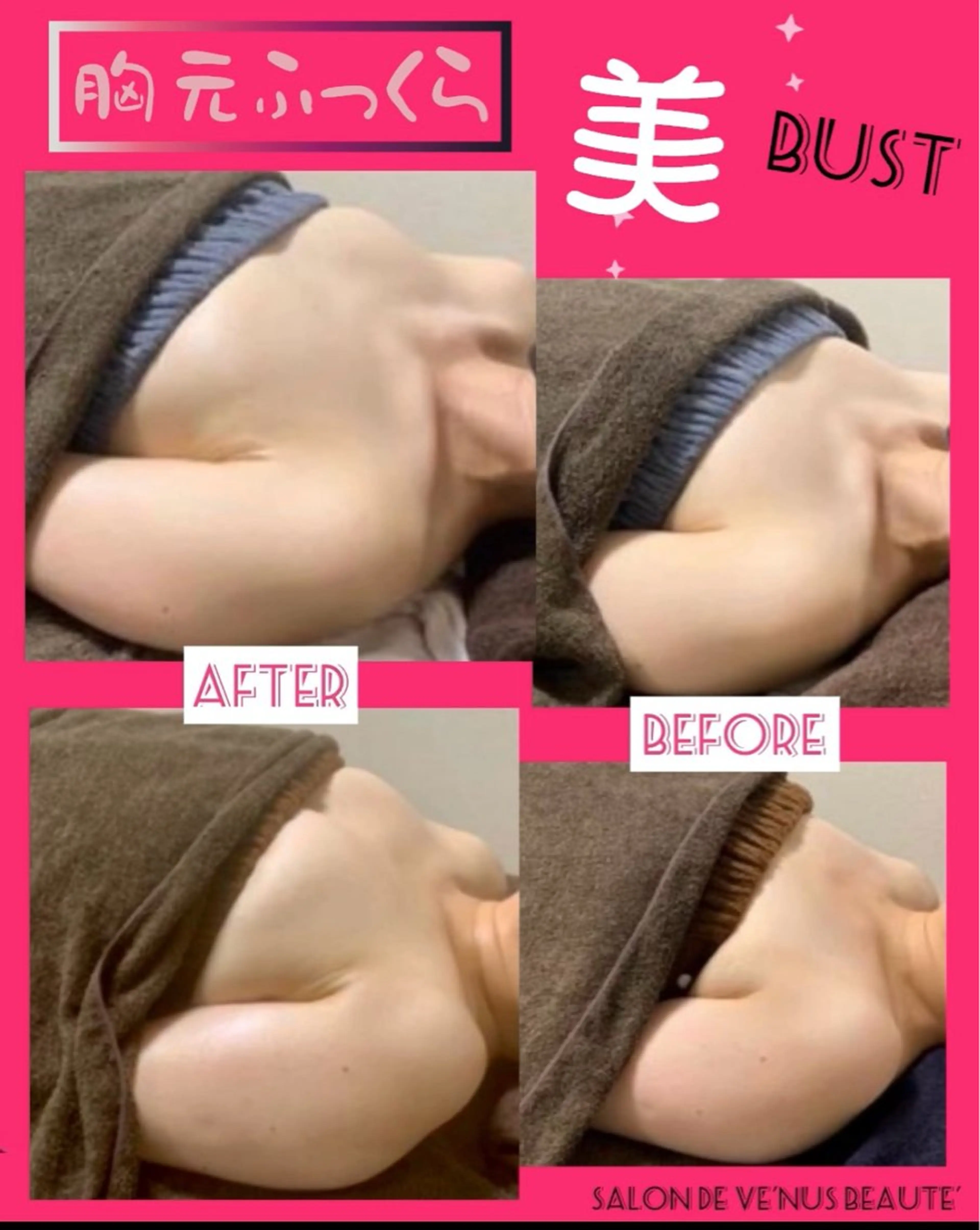 エステ ヴィーナス ビューティーのエステ・リラクイメージ