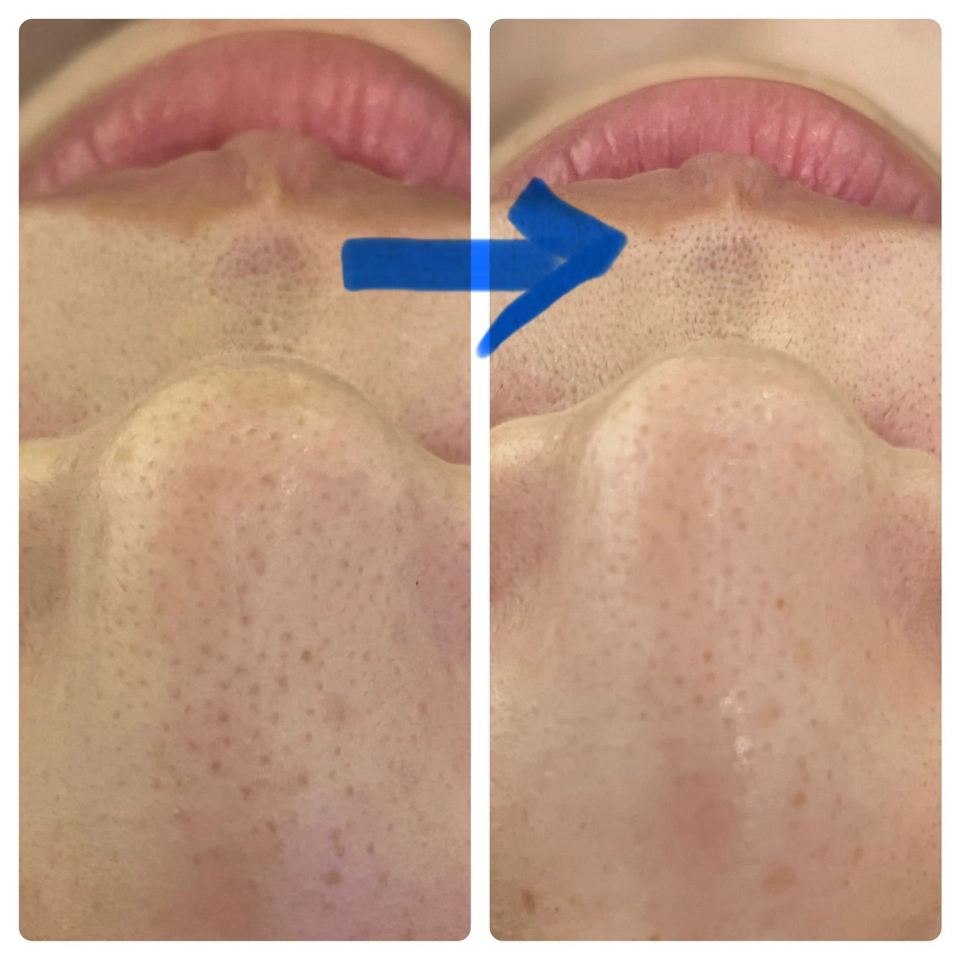 Blue Moon 【ブルームーン】のエステ・リラクイメージ