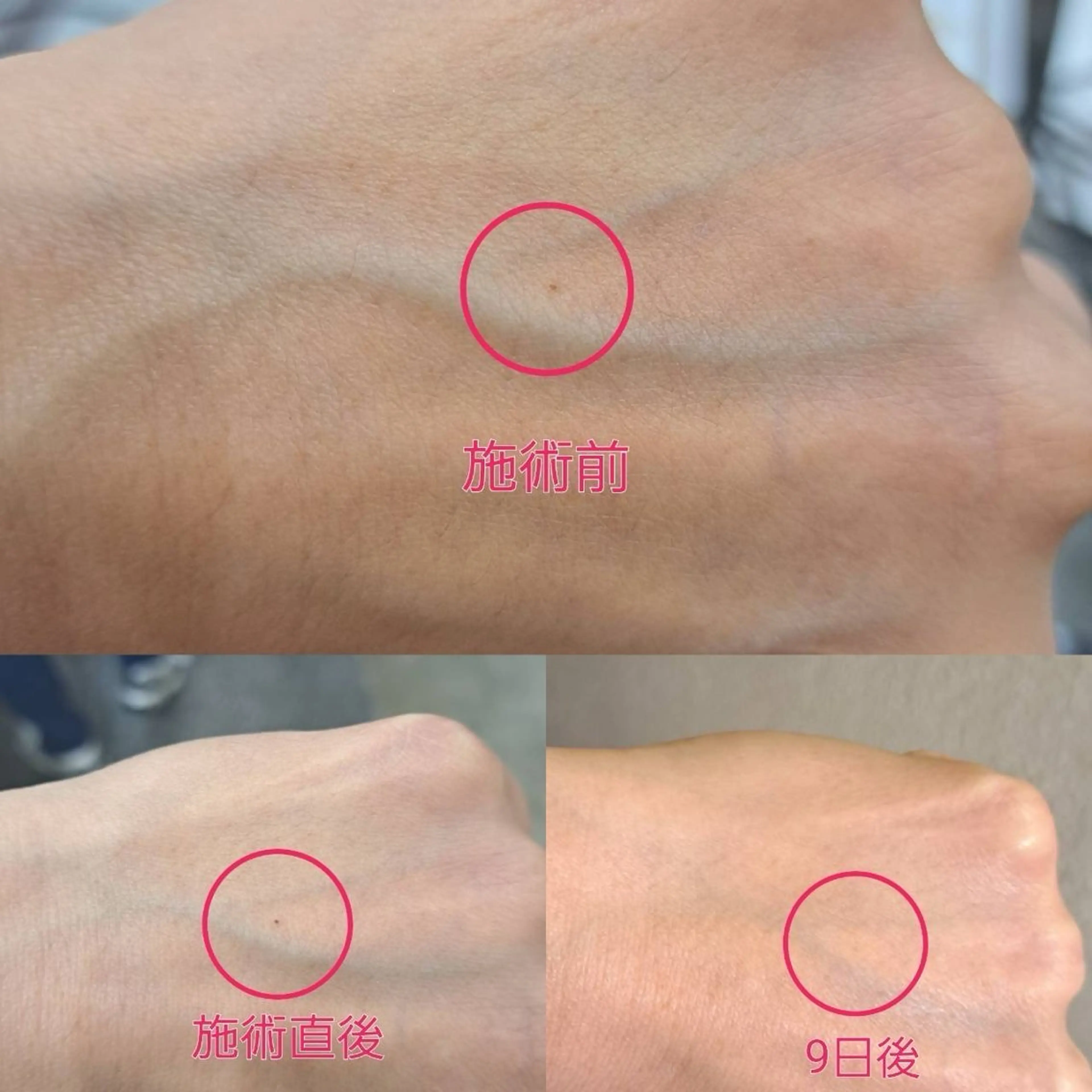 LiZA エステティックサロンのエステ・リラクイメージ