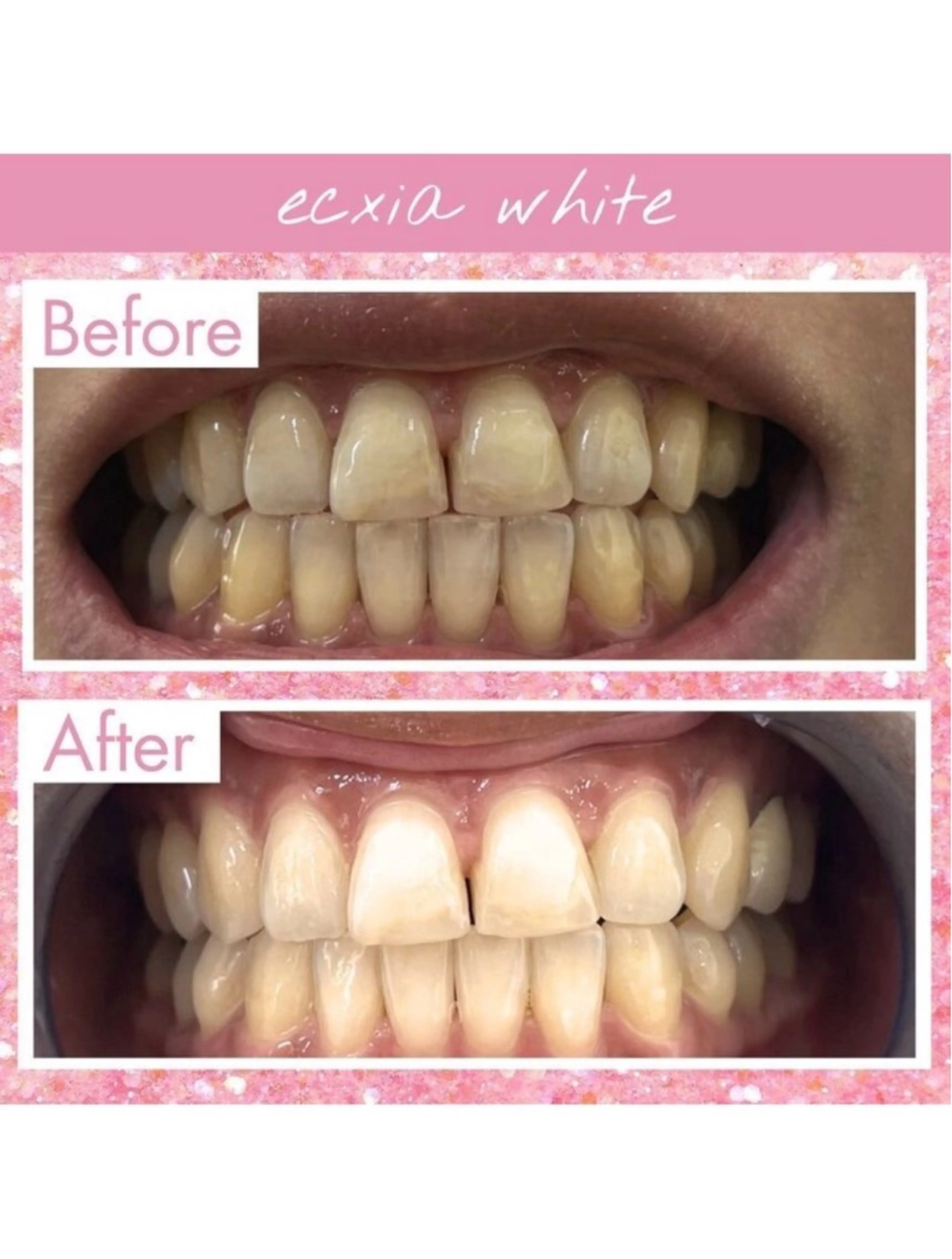 セルフホワイトニング エクシア武蔵小杉店のその他イメージ