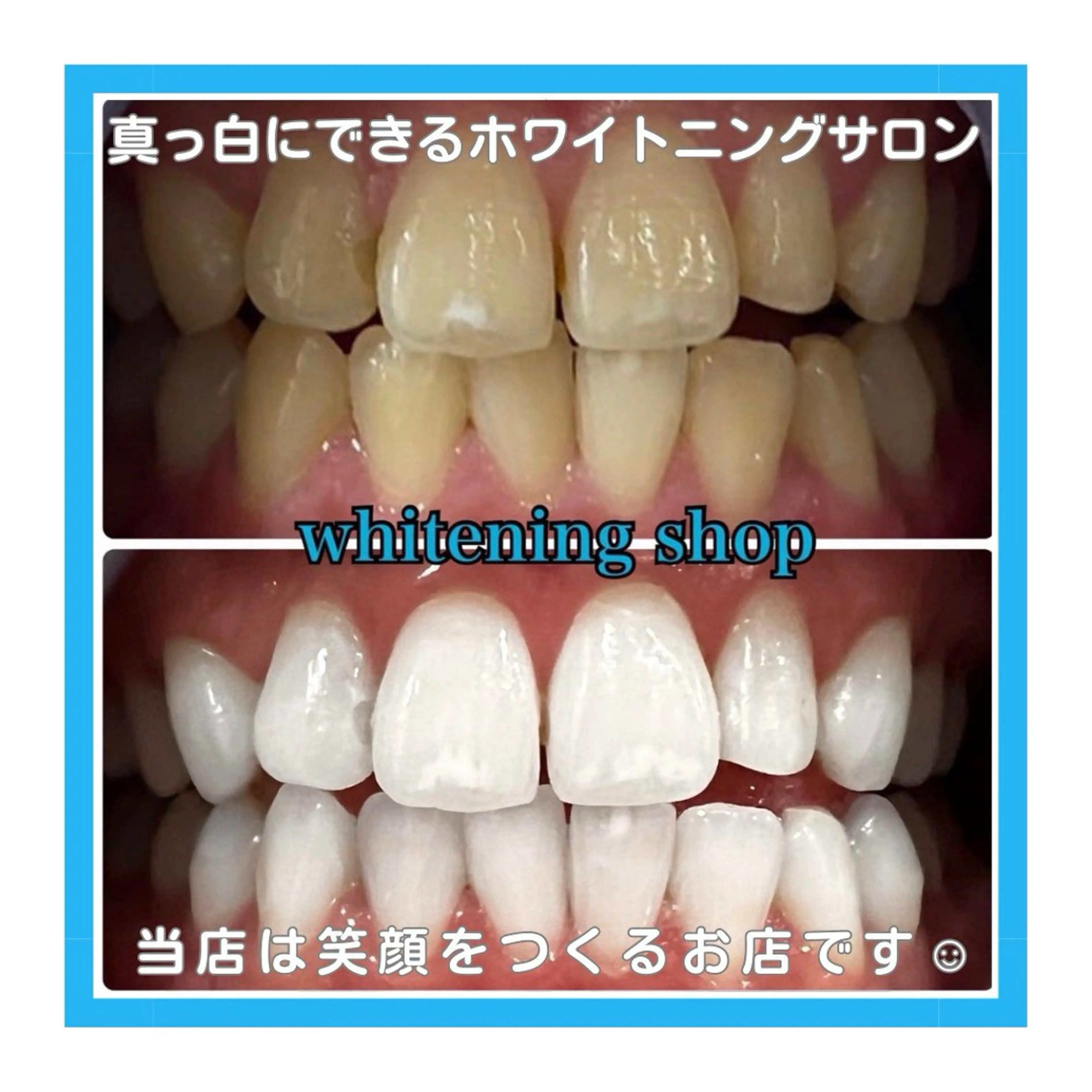 ホワイトニング ショップ浦和店のその他イメージ