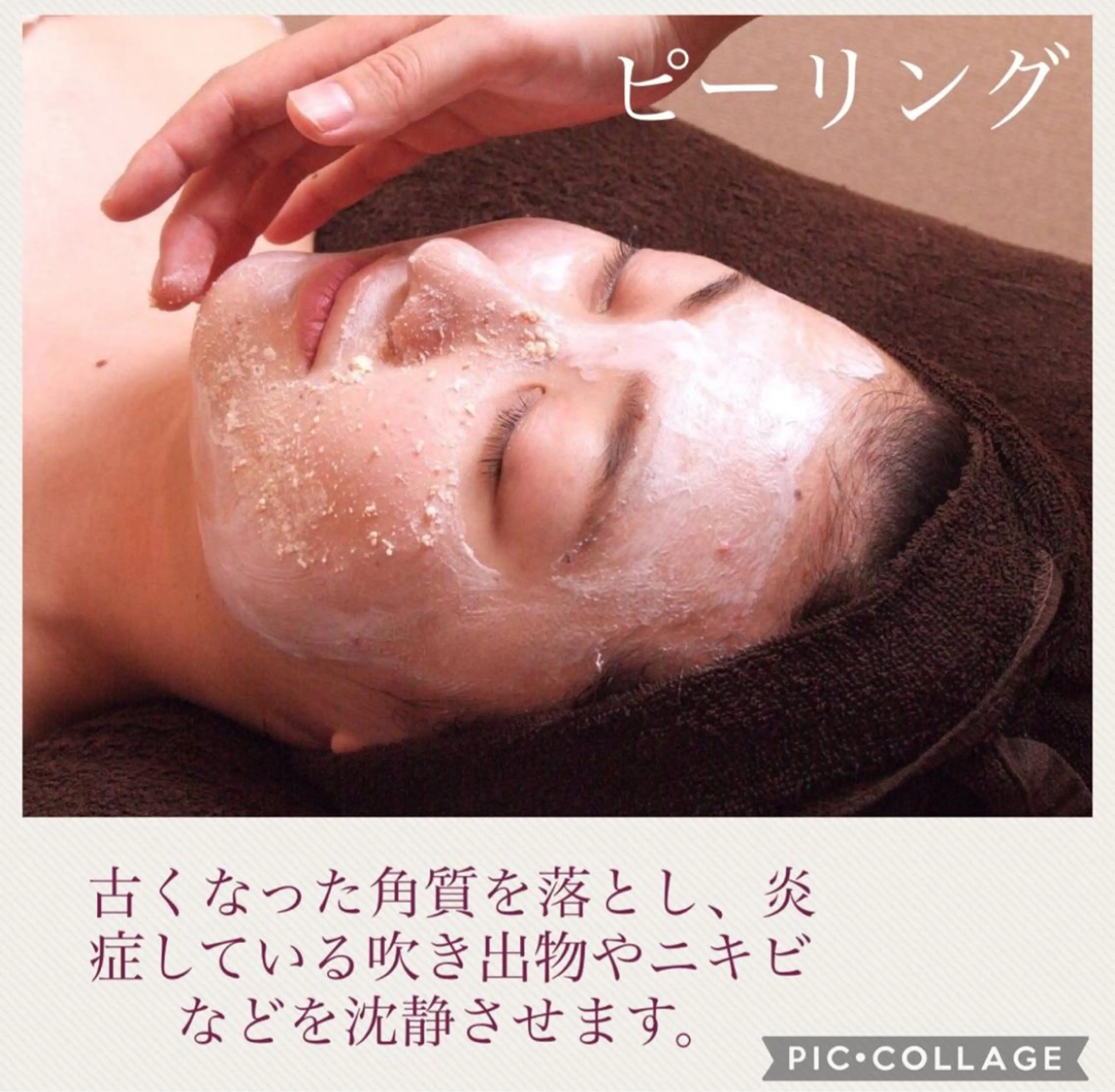 重度ニキビ専門🌷 ダウンタイムなしのエステ・リラクイメージ