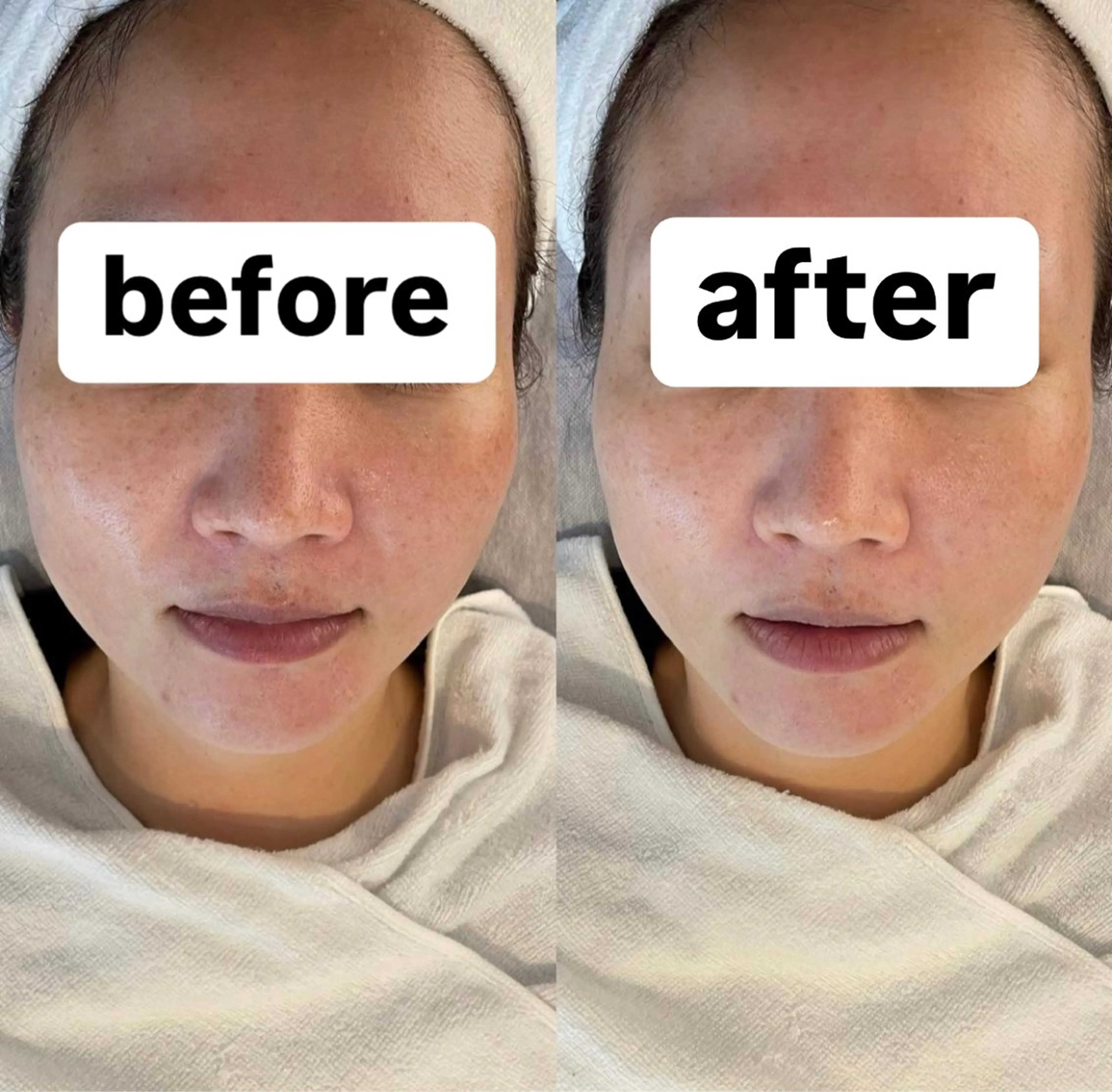 エステ ✨ナリス化粧品✨ Shinyのエステ・リラクイメージ