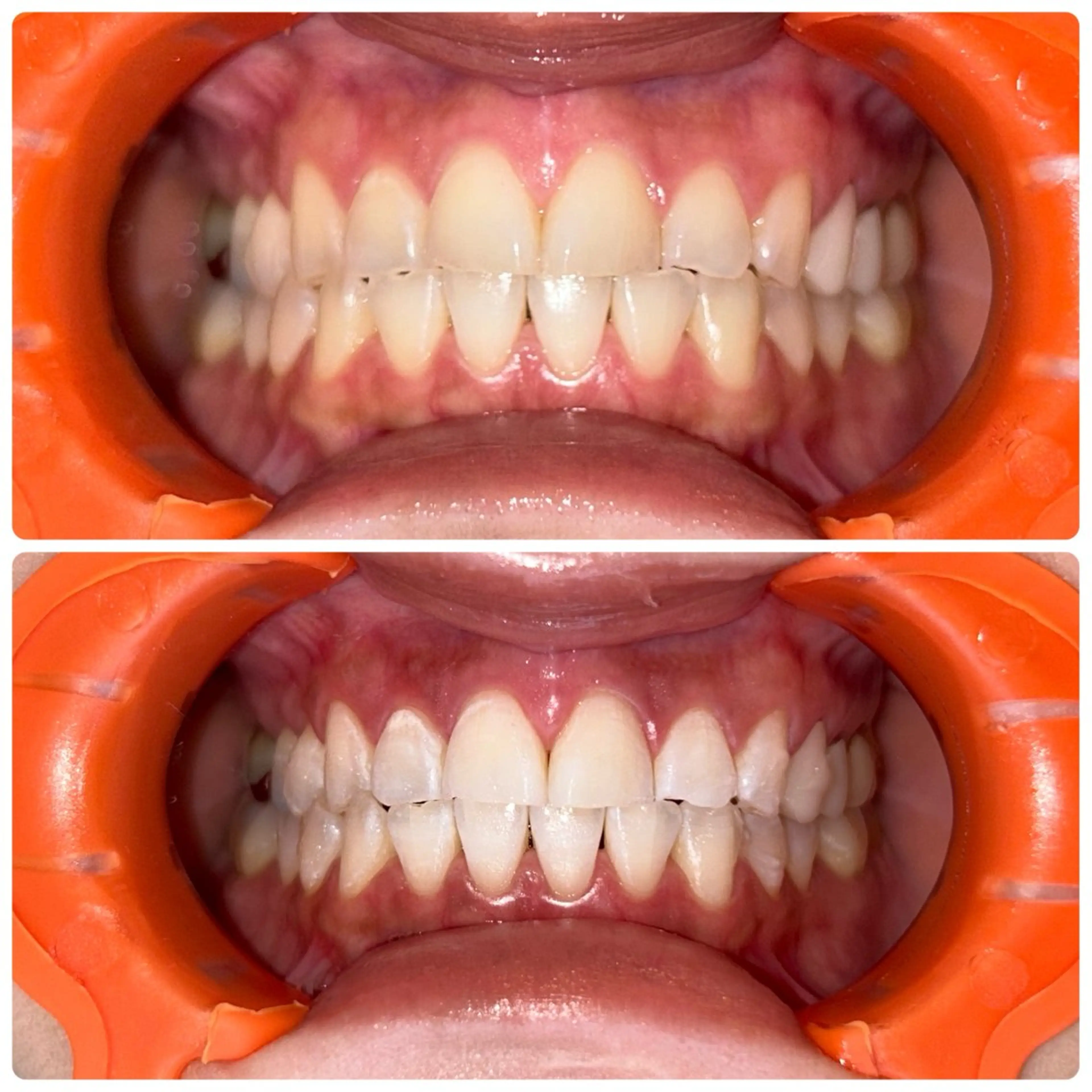 エステ cona whitening神保町所属・ホワイトニング 神保町店/杉浦のエステ・リラクイメージ