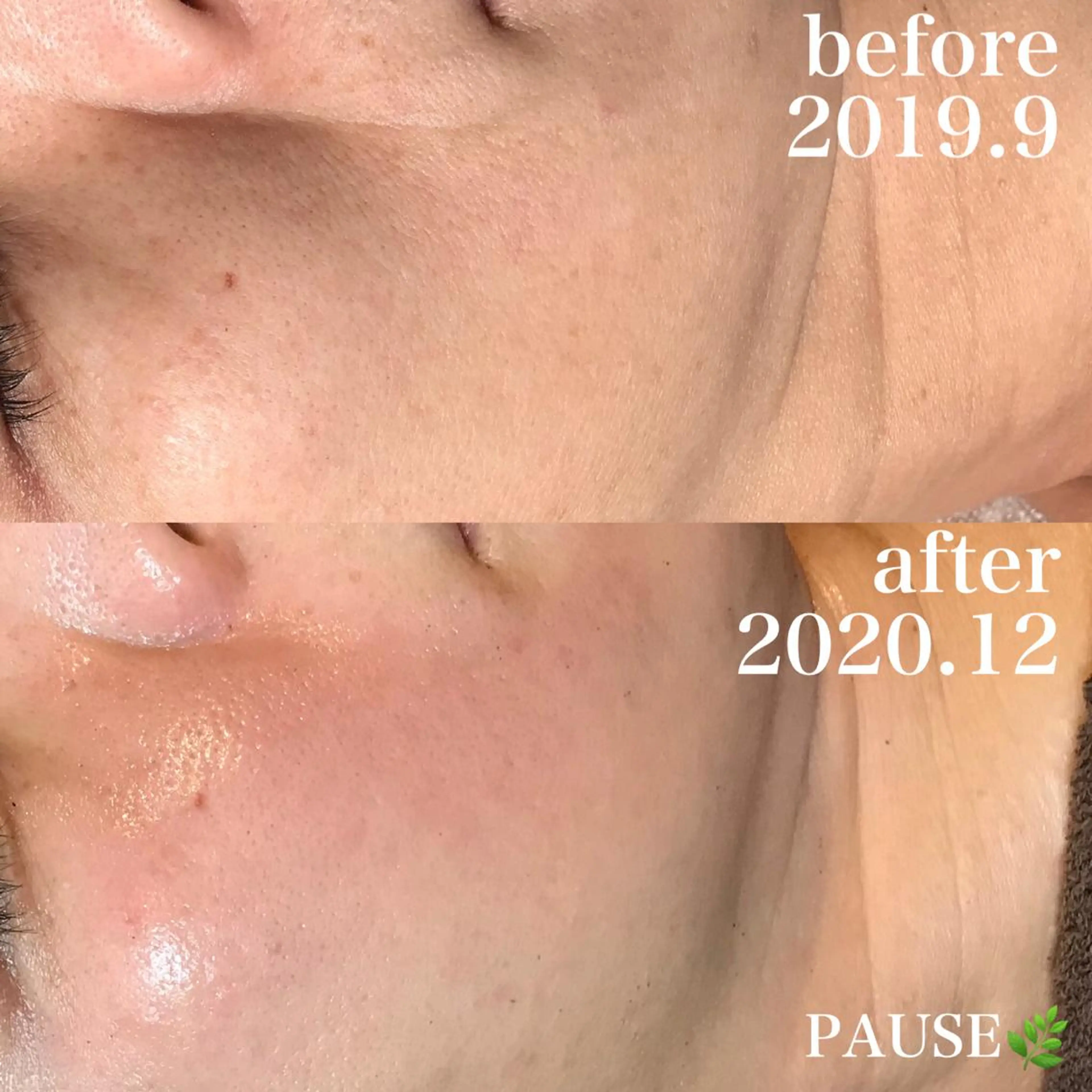 エステ 浜野 恵美のエステ・リラクイメージ