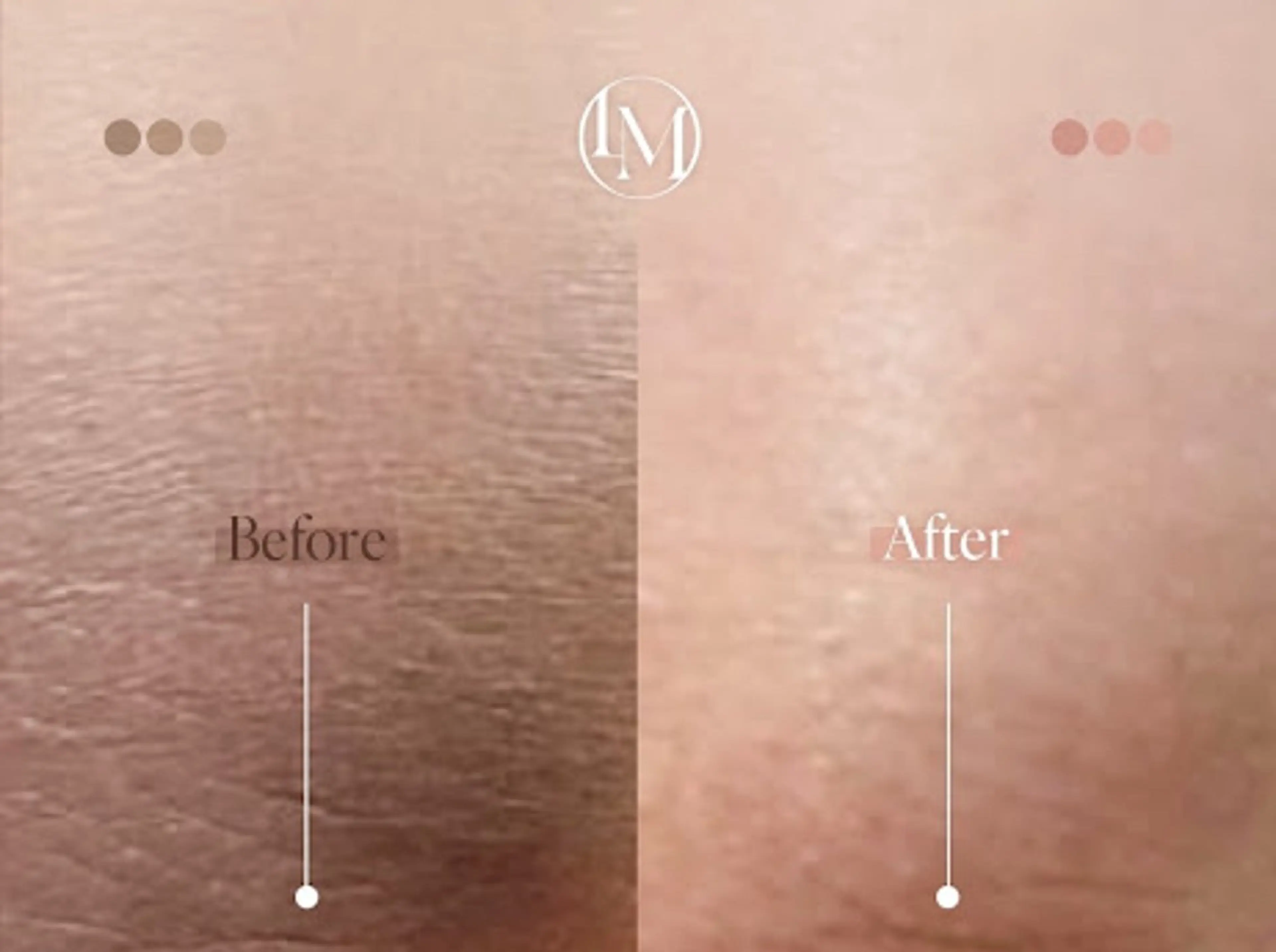 MOMO BEAUTY所属・Momo beautyのその他イメージ