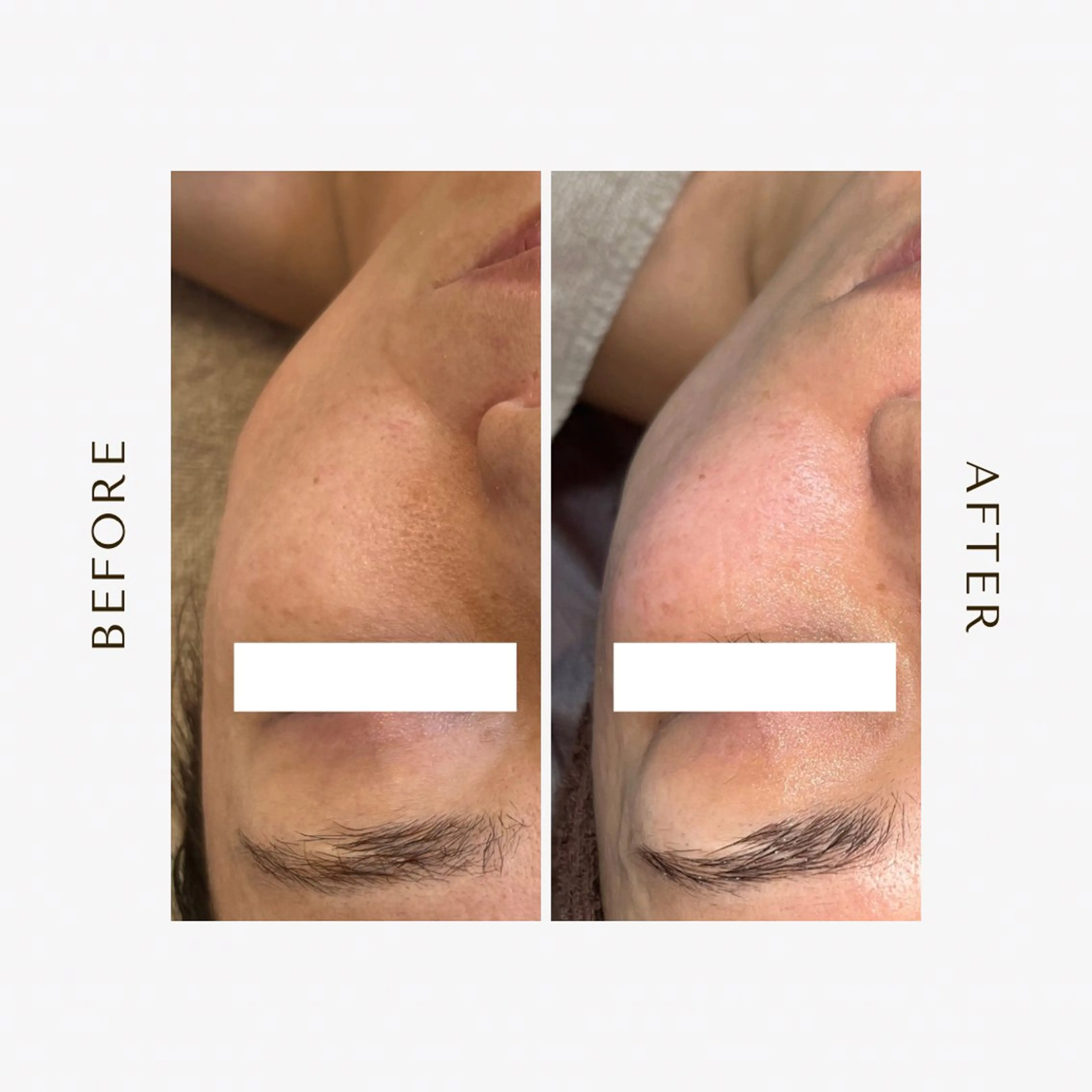 人気No.1✨機械2種使用＋デコルテマッサージ込み💆‍♀️▶ ハリ・シワ・美白を同時にスペシャルケア❗️の写真