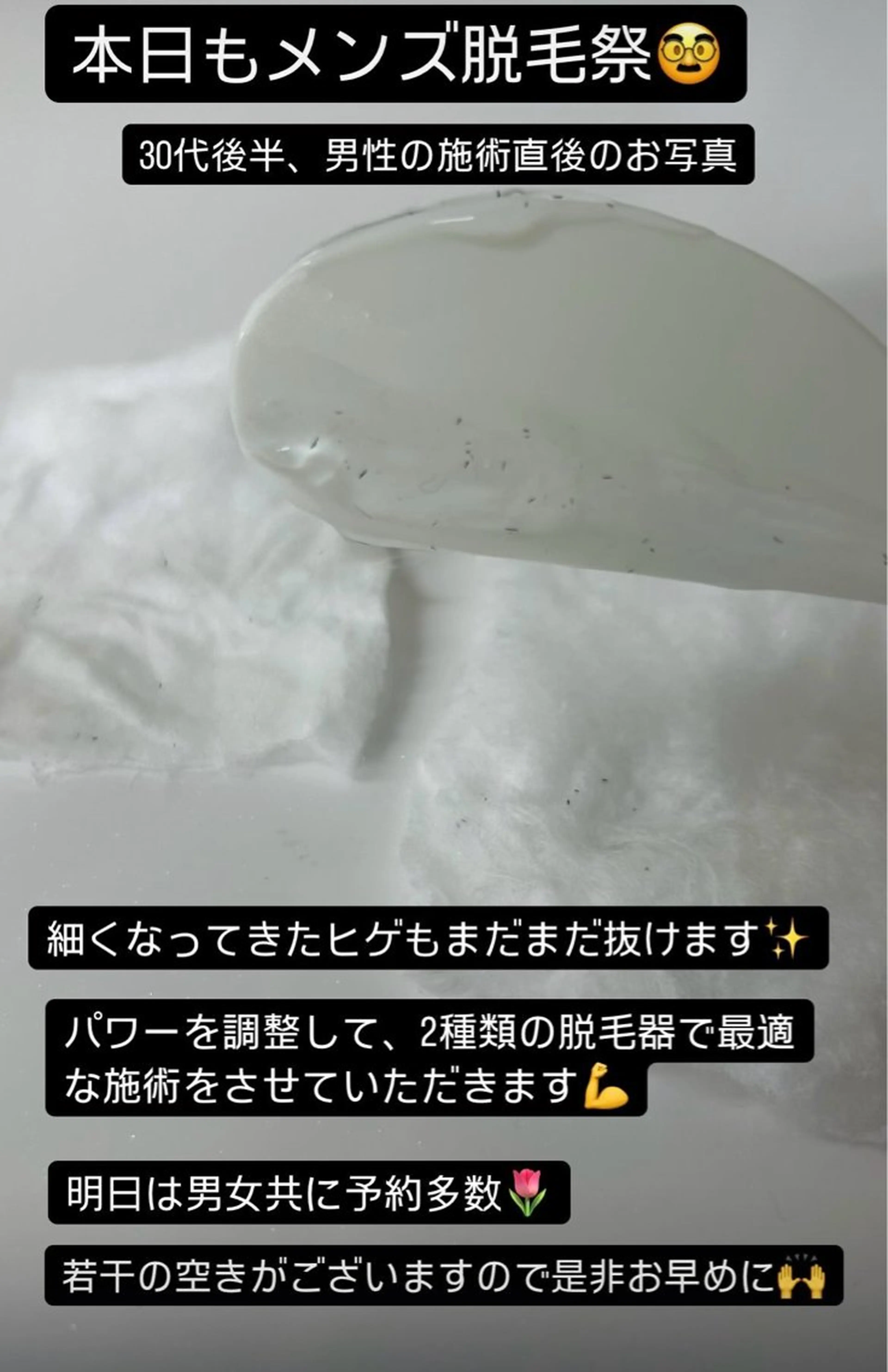 メンズ 脱毛サロン BRIDGE橋本のエステ・リラクイメージ