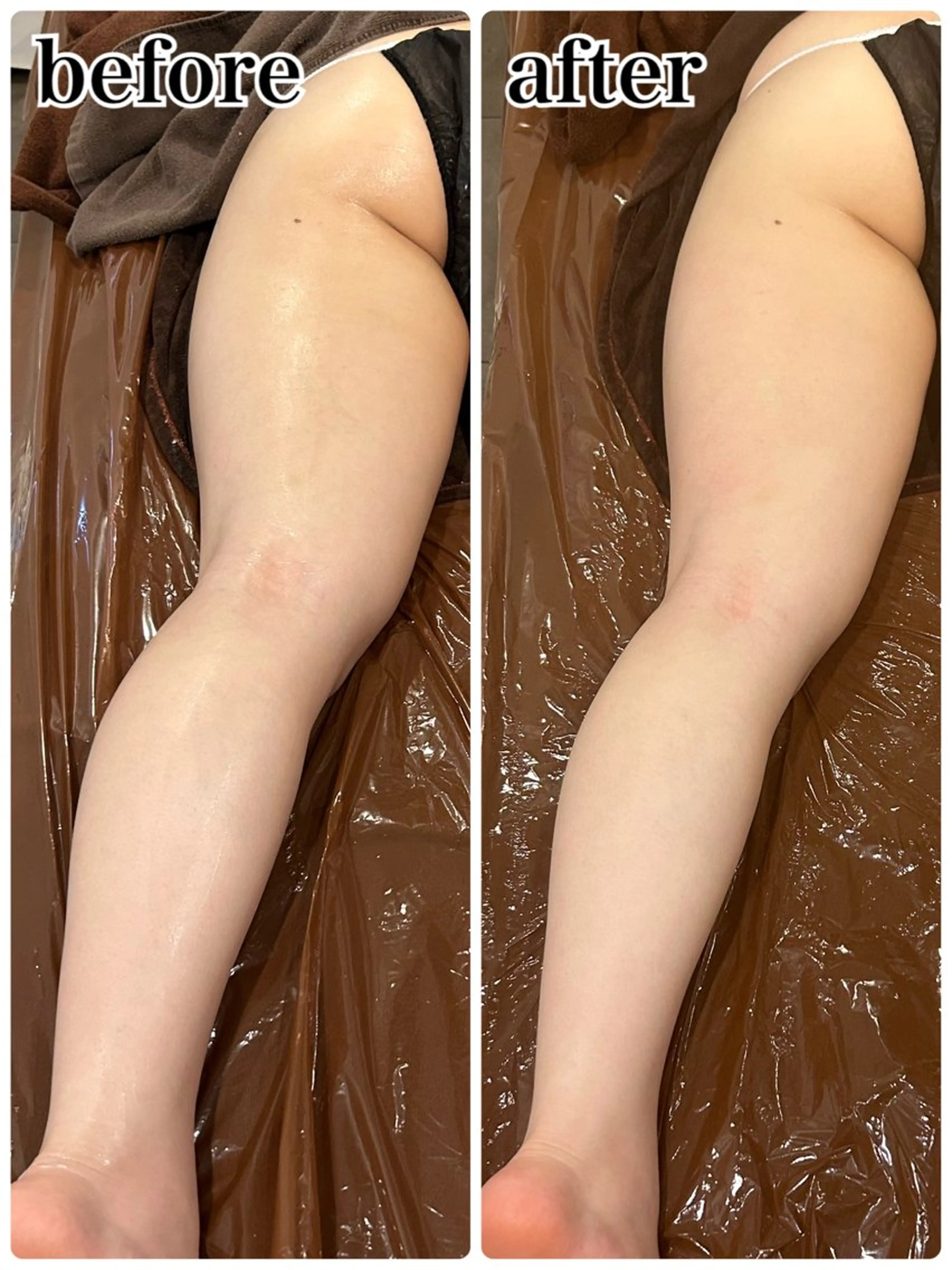 エステ Gemini MIKIのエステ・リラクイメージ