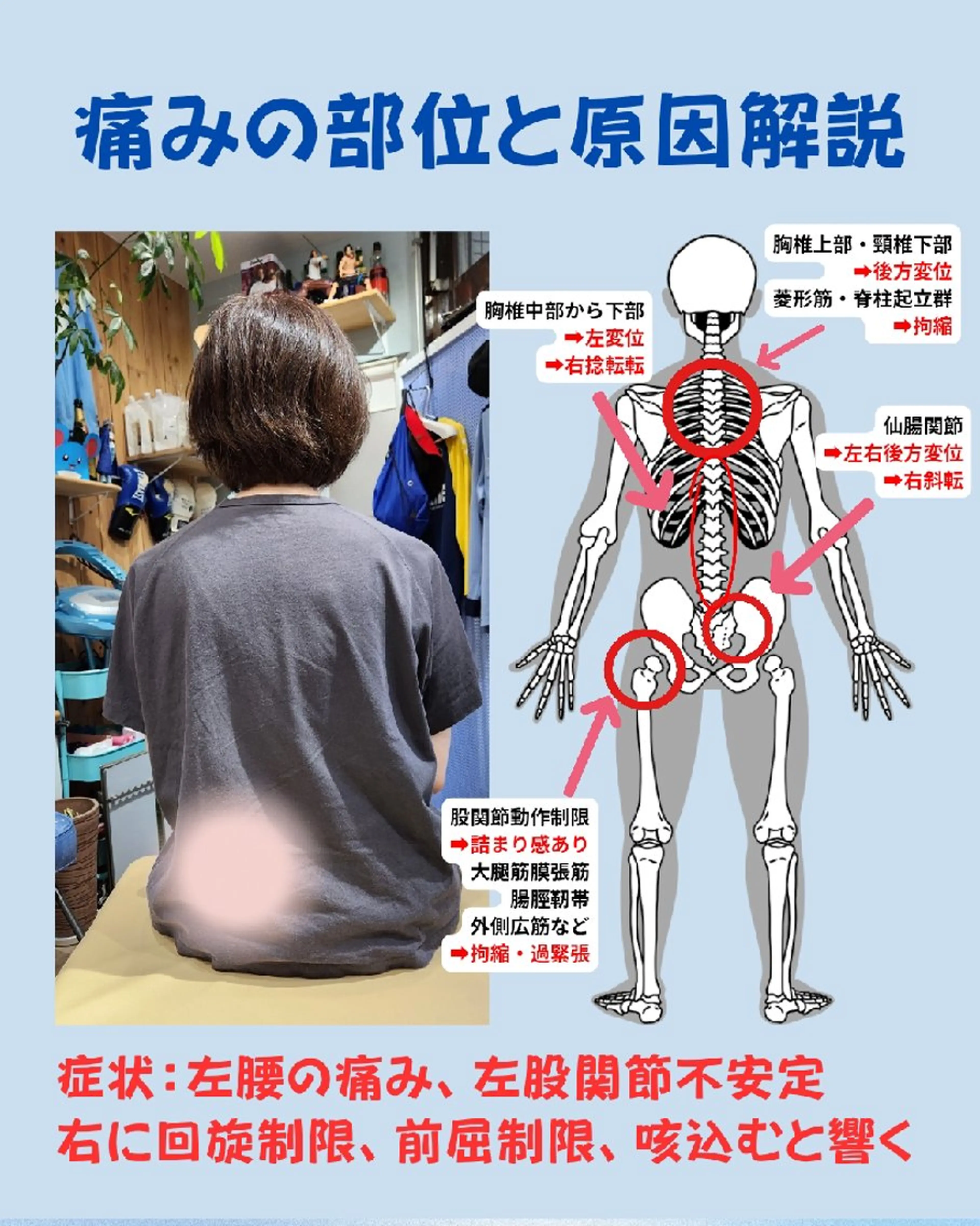 【5/27背骨の日限定】歪みチェック&ペア矯正(カウンセリング時間含む)の写真