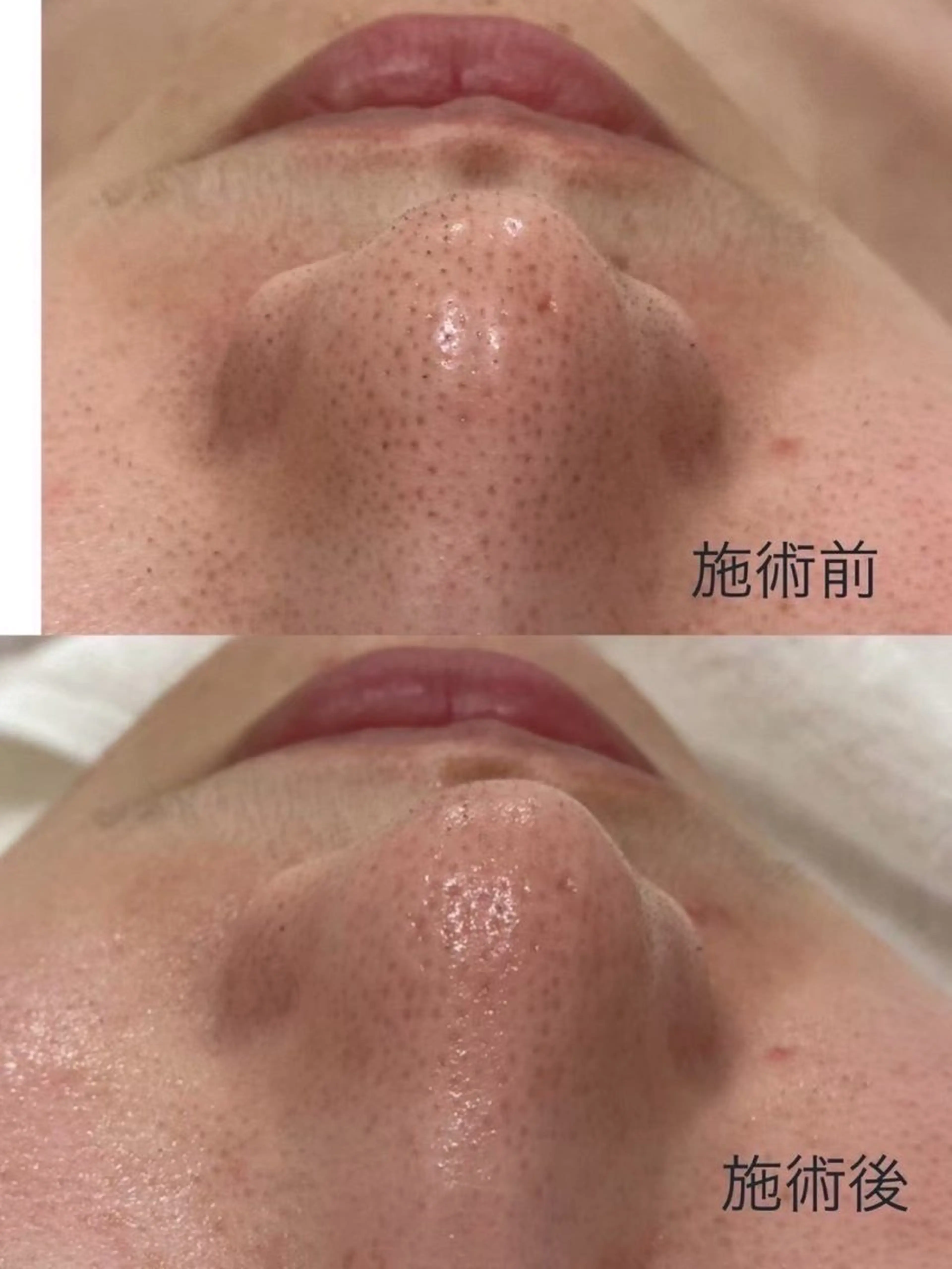 六本木脱毛andS さおりのエステ・リラクイメージ