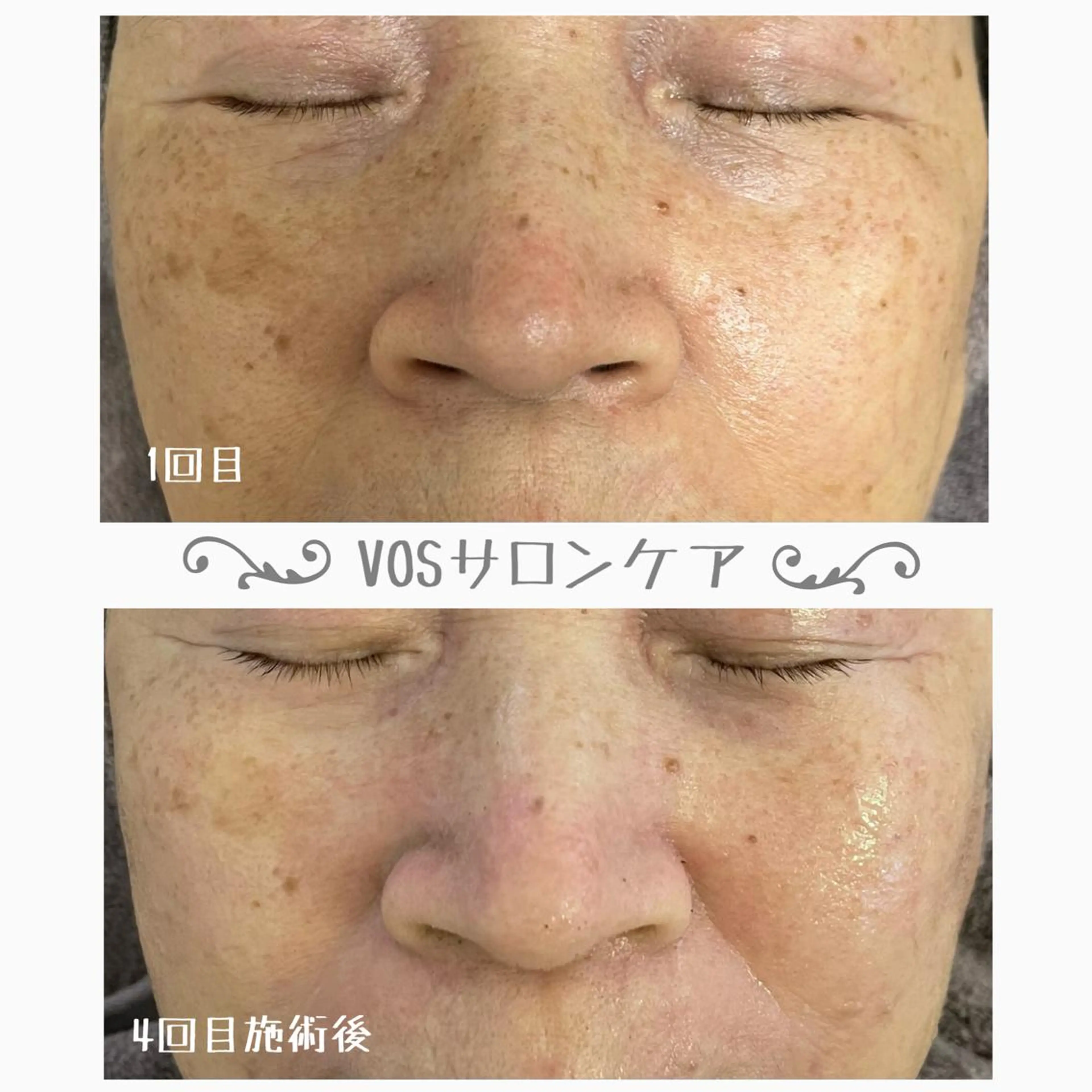 1ヶ月後も半分残る 高持続LEDエクステのマツエク・マツパデザイン