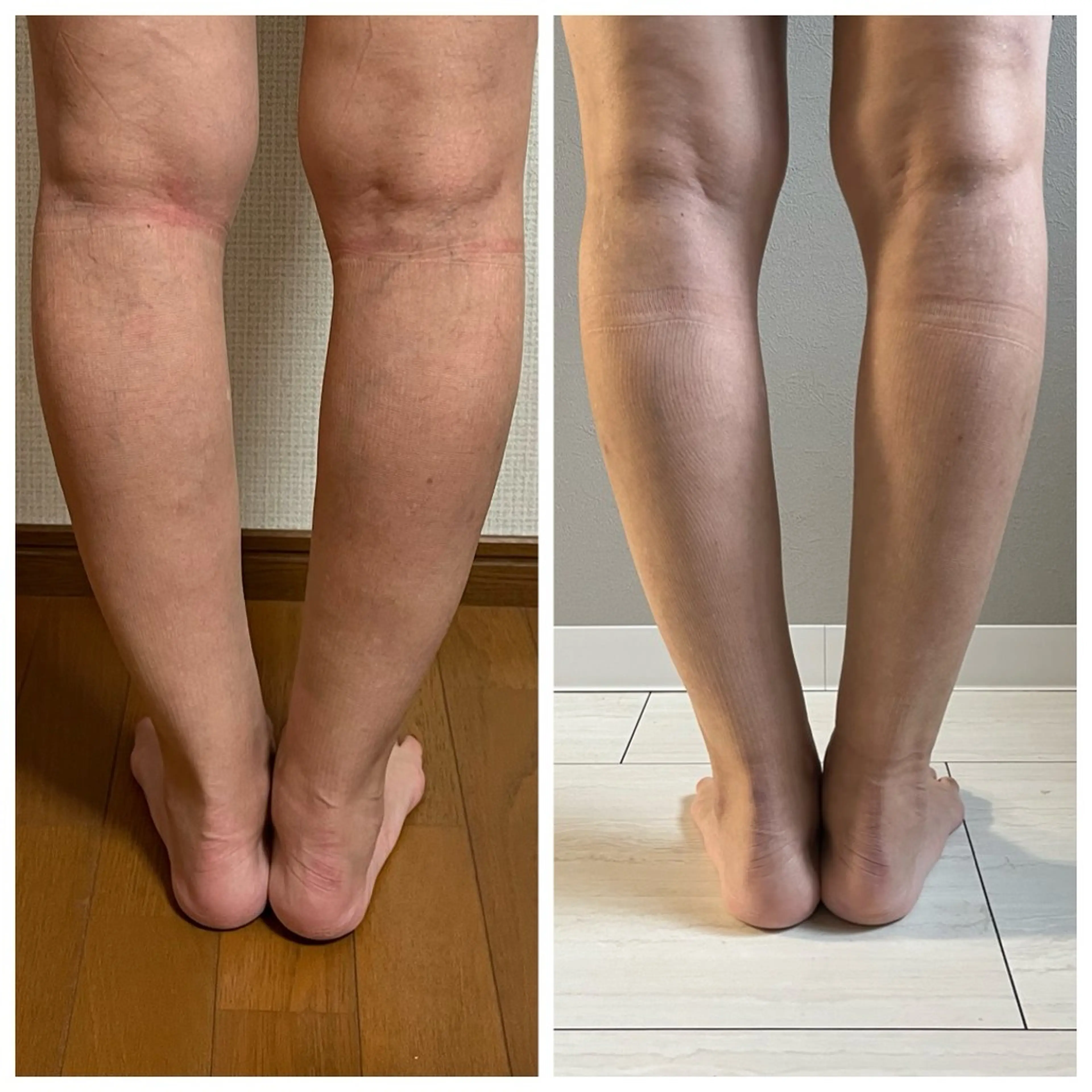 血流改善+内臓温熱ケアコースの写真