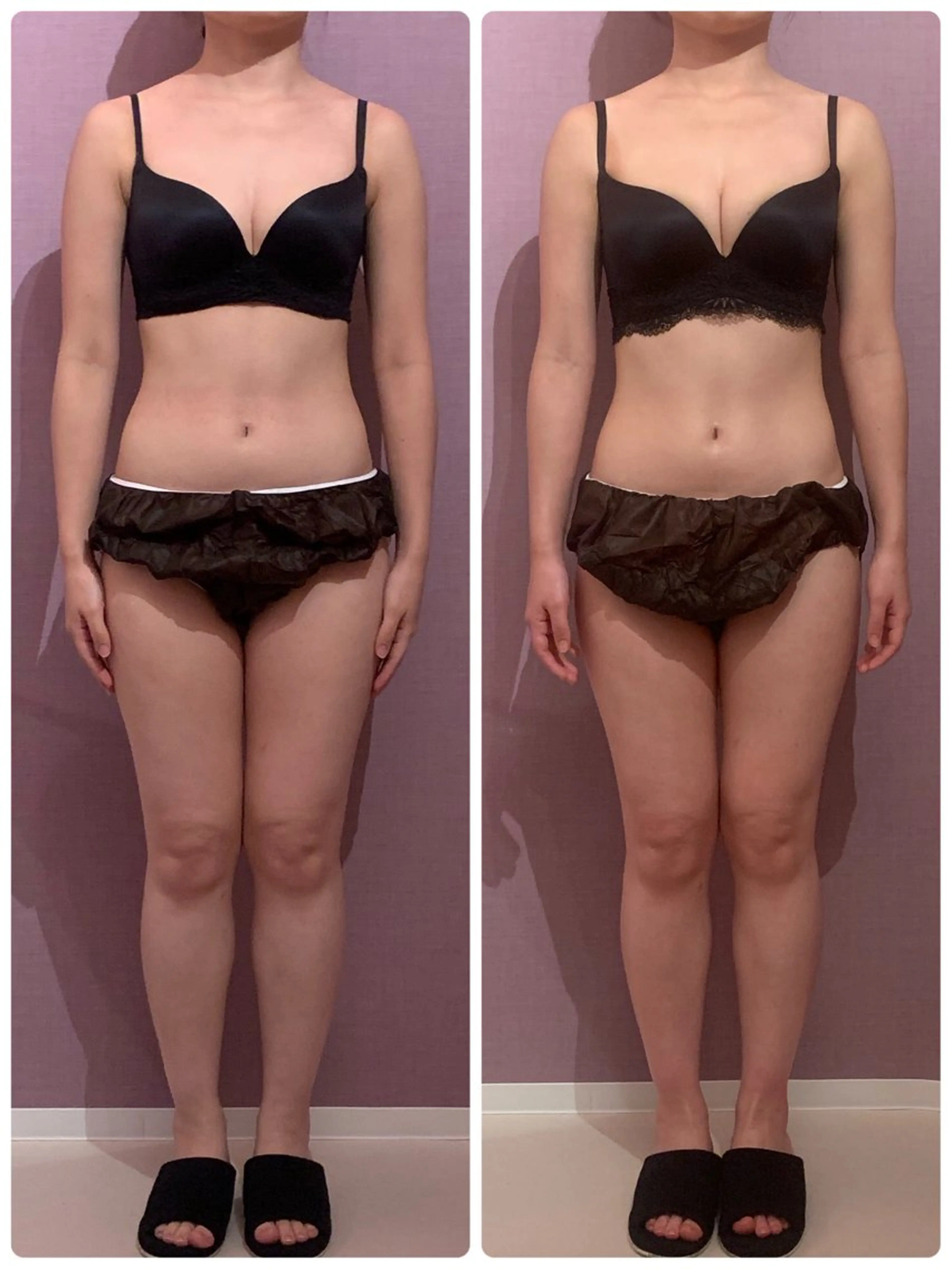 エステ リラク アンベリーノ Yuuriのエステ・リラクイメージ