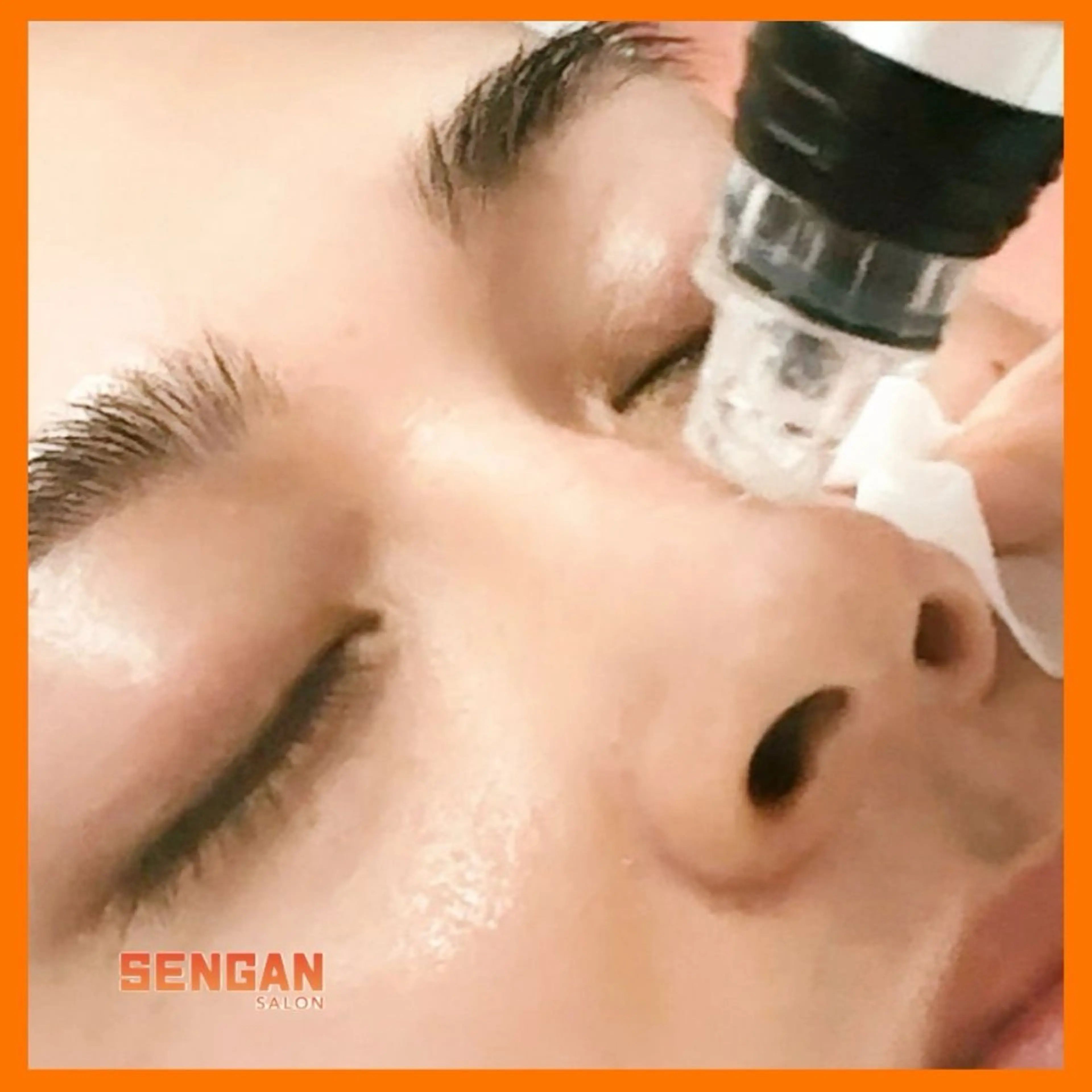 エステ 洗顔サロン池袋 毛穴洗浄のその他イメージ