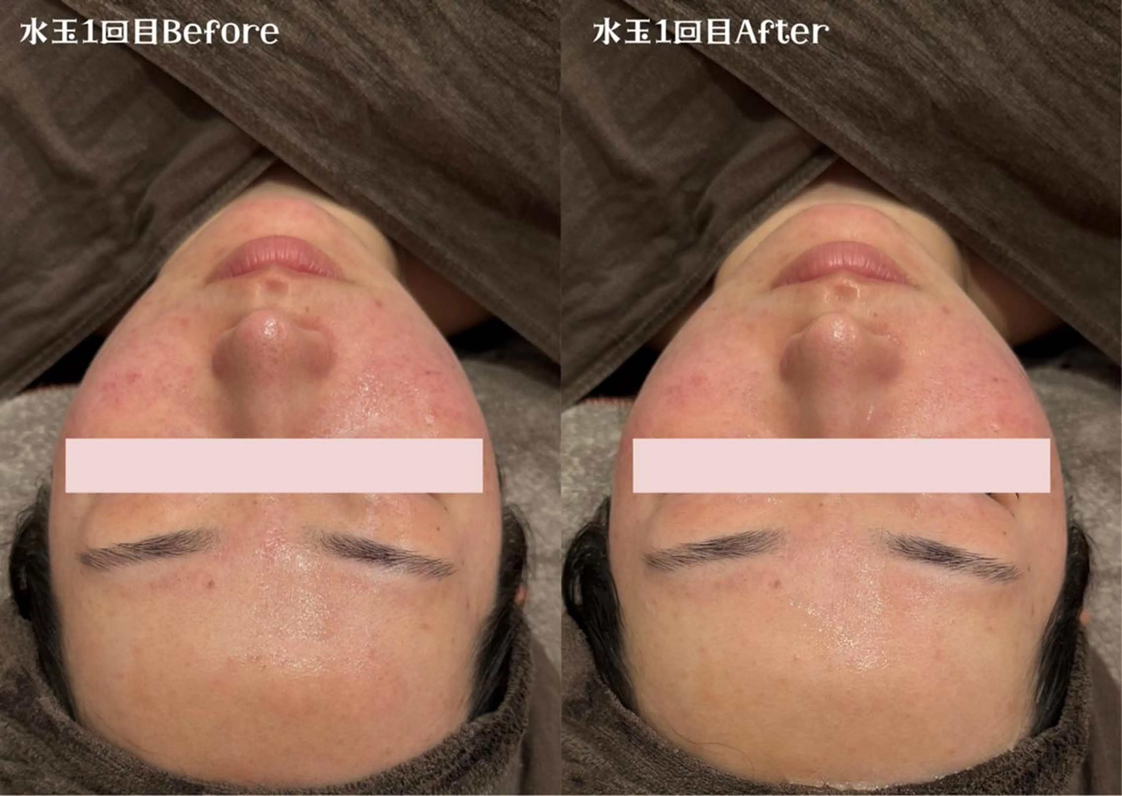 LDM水玉リフティングの写真