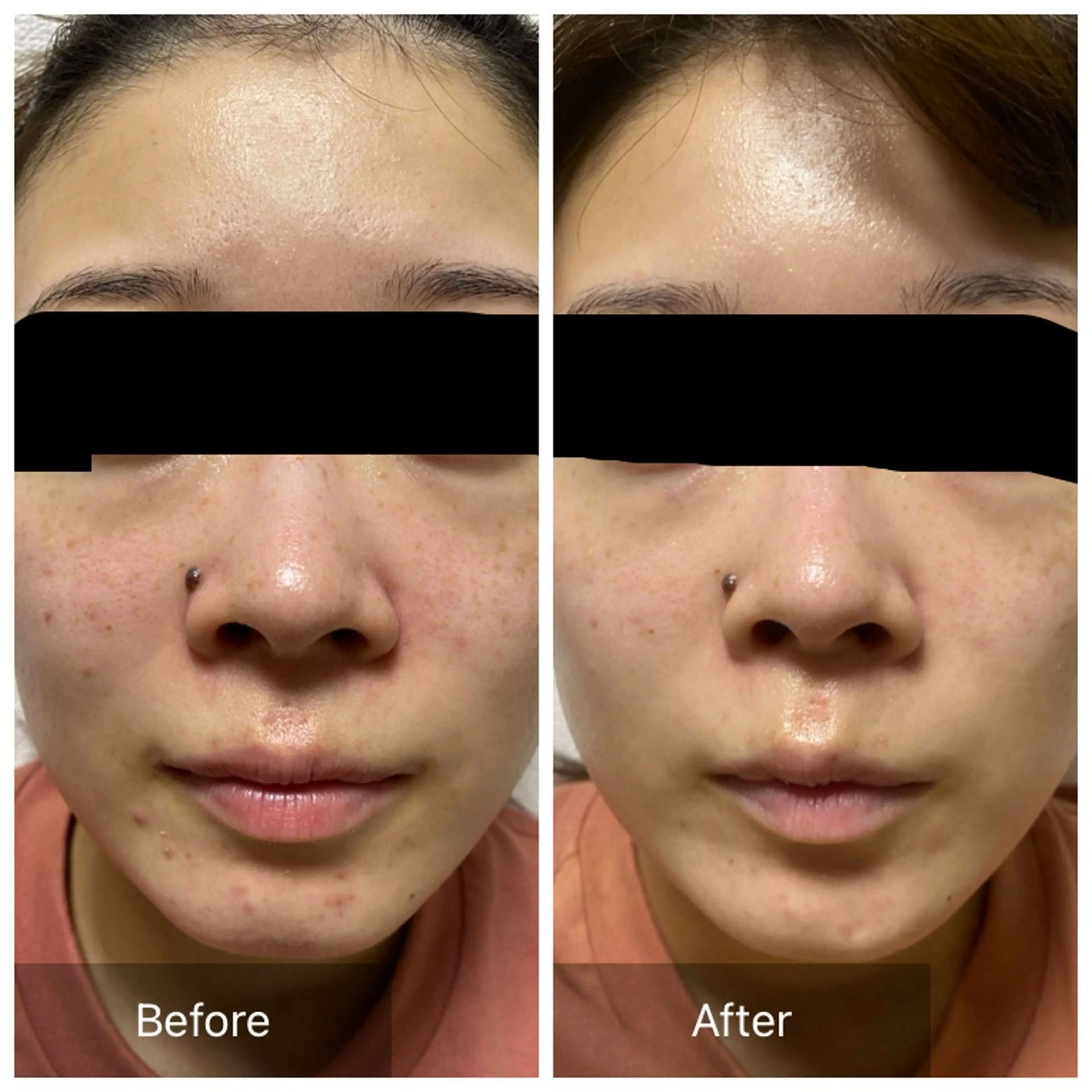 エステ Beauty  Studio CARO所属・ビューティースタジオ カーロのその他イメージ