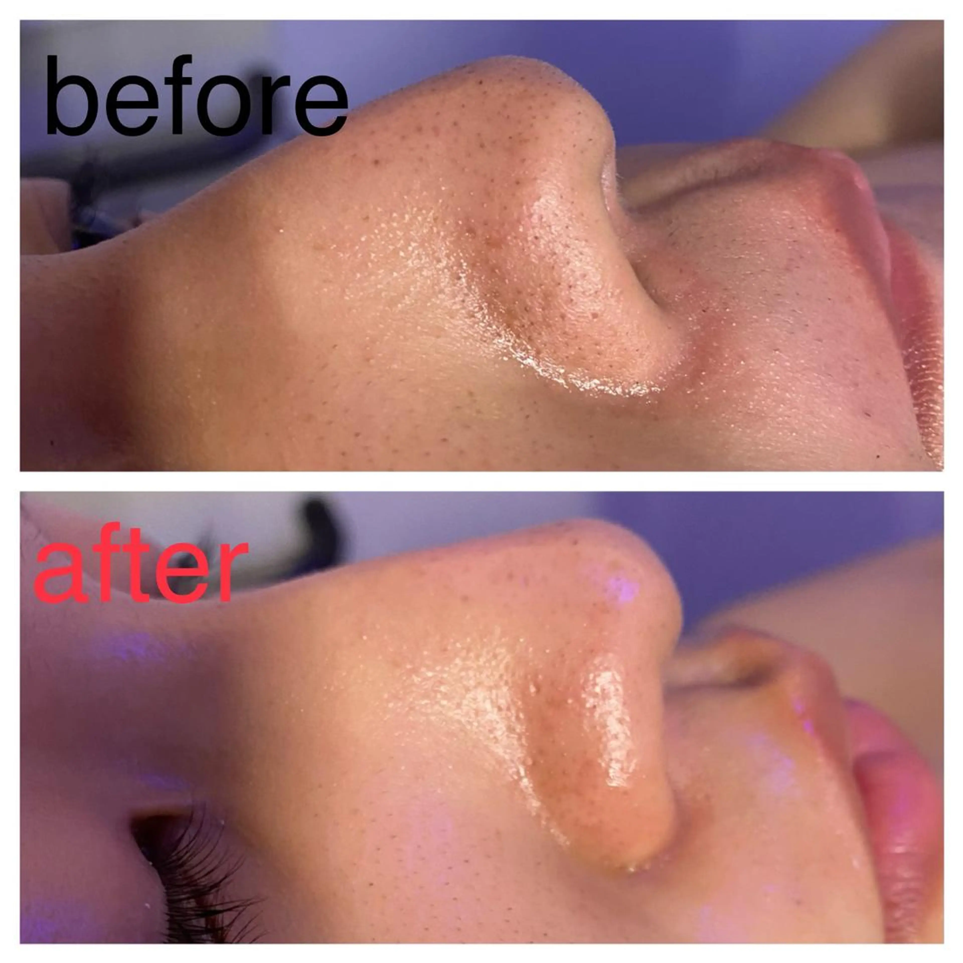 エステ 毛穴フェイシャル エステ専門店BBのエステ・リラクイメージ