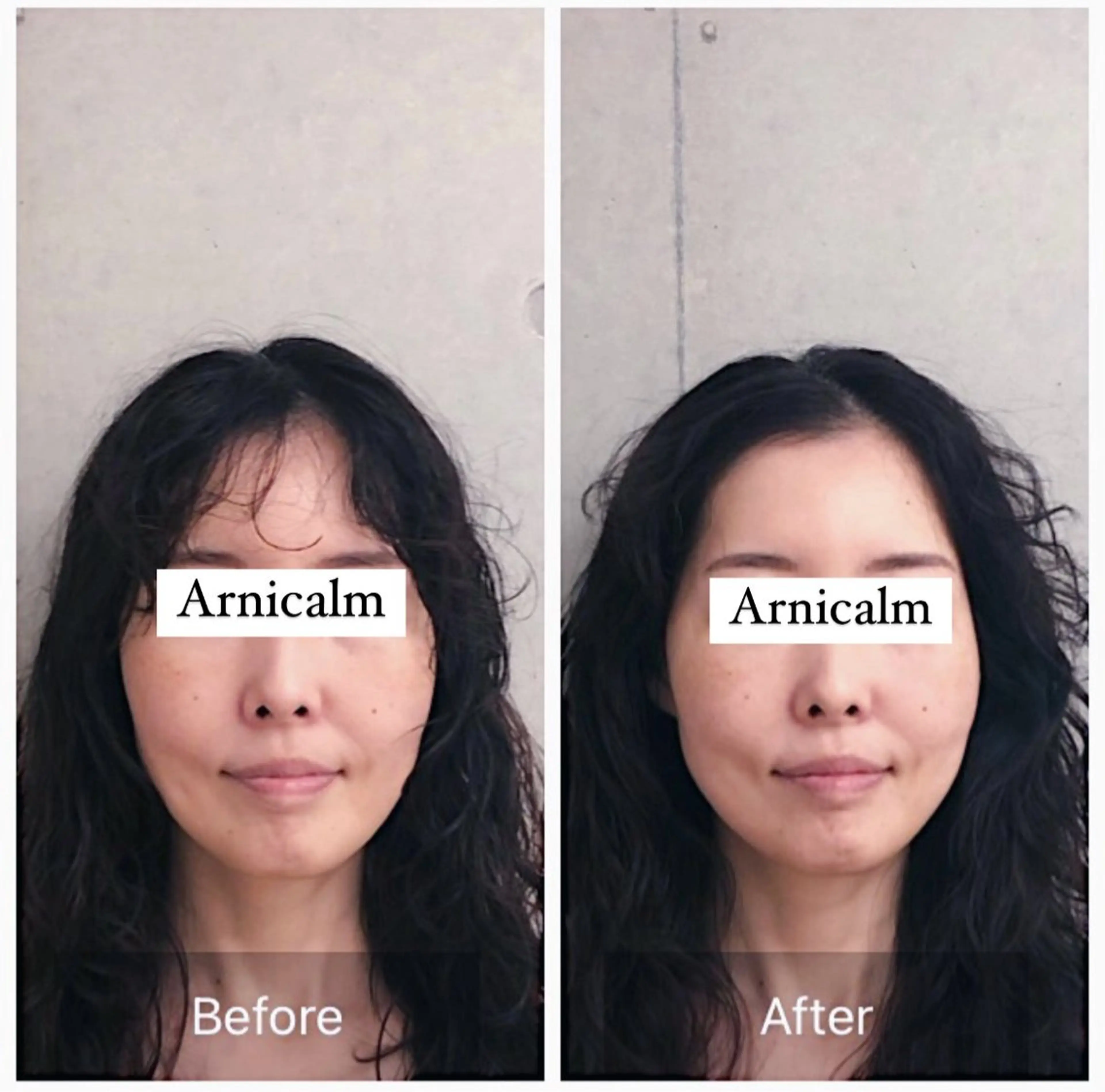 ハーブピーリング 肌再生ピーリング/のエステ・リラクイメージ