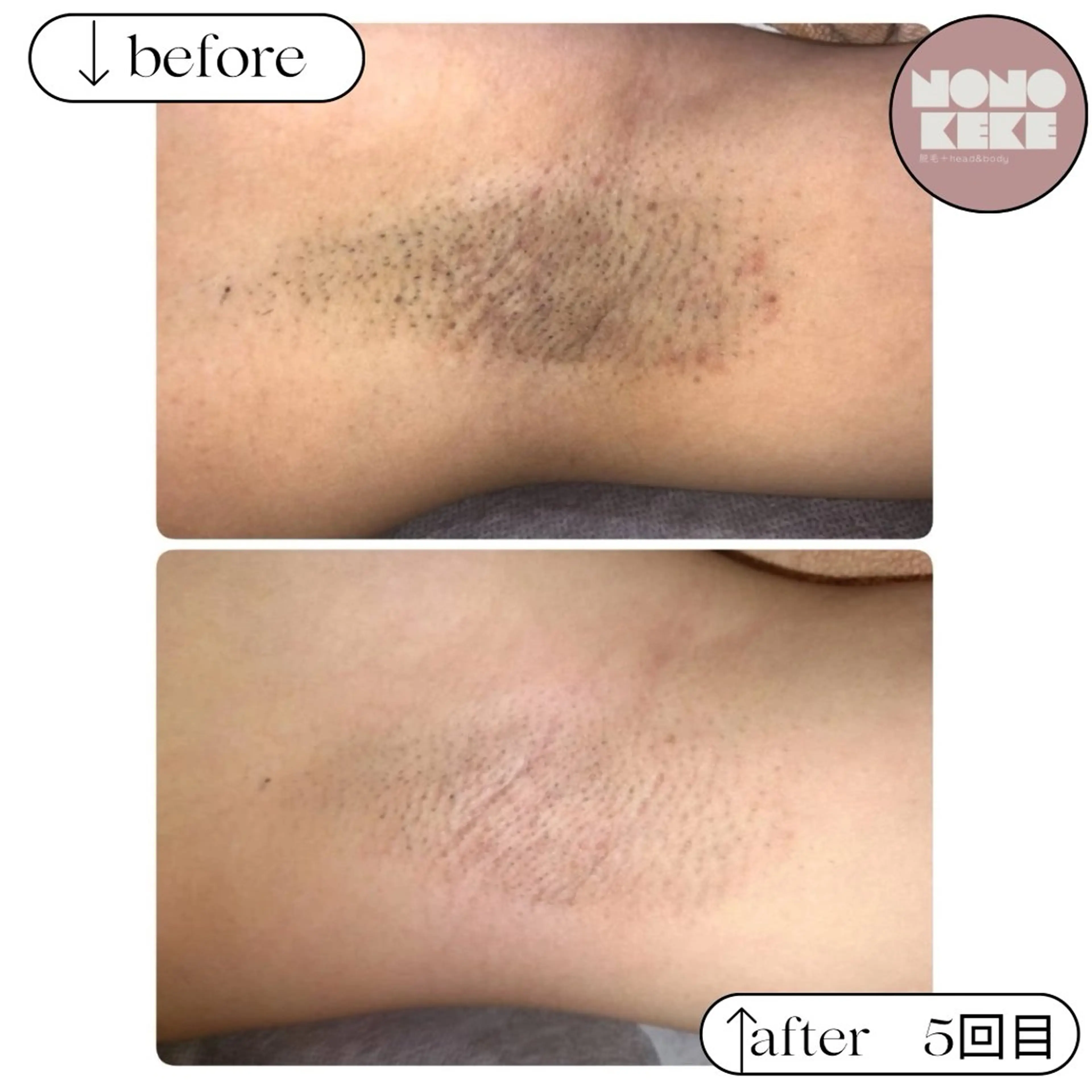 NONOKEKE ノノケケのエステ・リラクイメージ