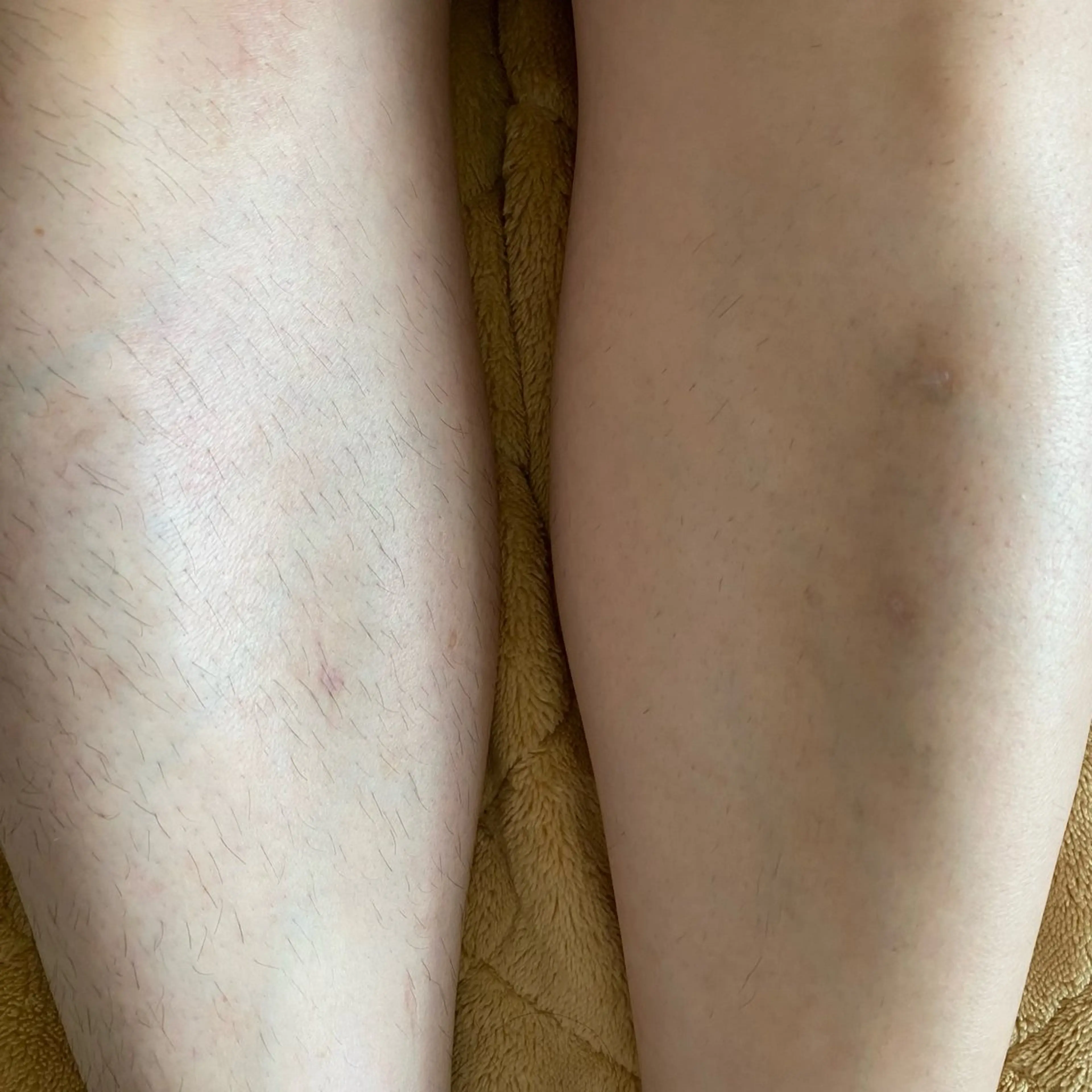 メンズ 脱毛 Beauty  Studio CARO所属・ビューティースタジオ カーロのその他イメージ