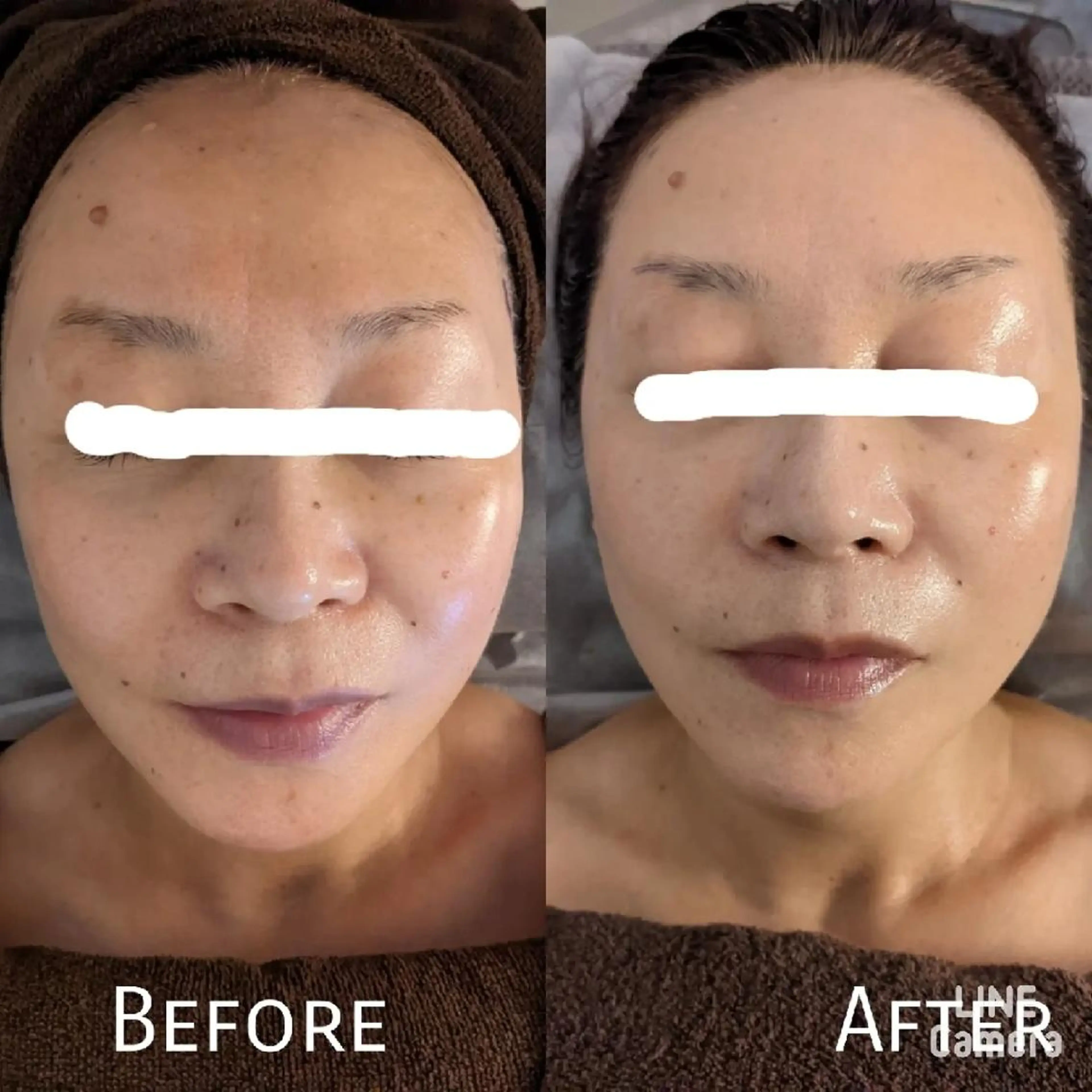 ﾌｪｲｼｬﾙｴｽﾃ ﾗﾄｩｰﾙ伊深のエステ・リラクイメージ