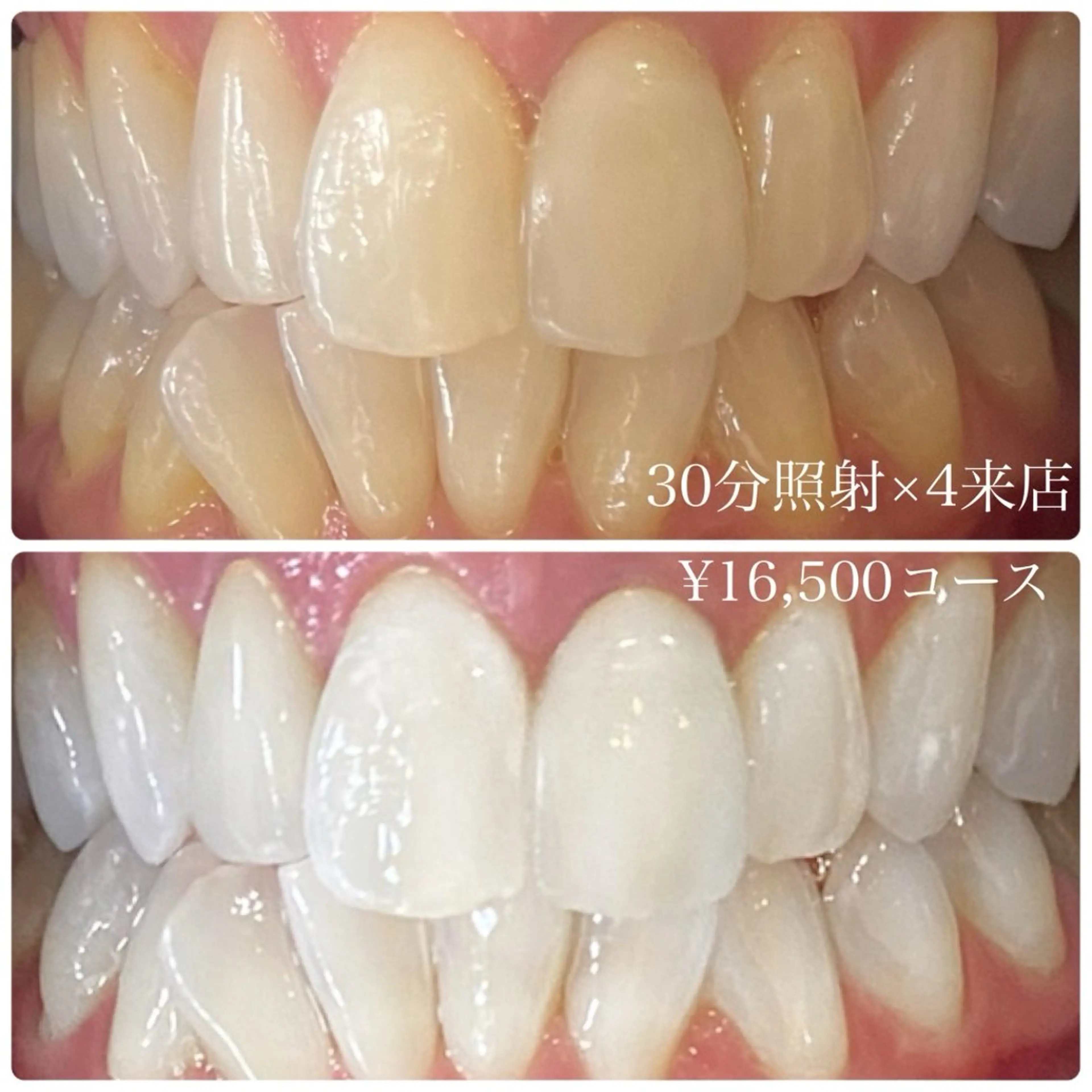 PLATINUM Beauty 横浜店所属・ホワイトニングルーム 横浜店のその他イメージ