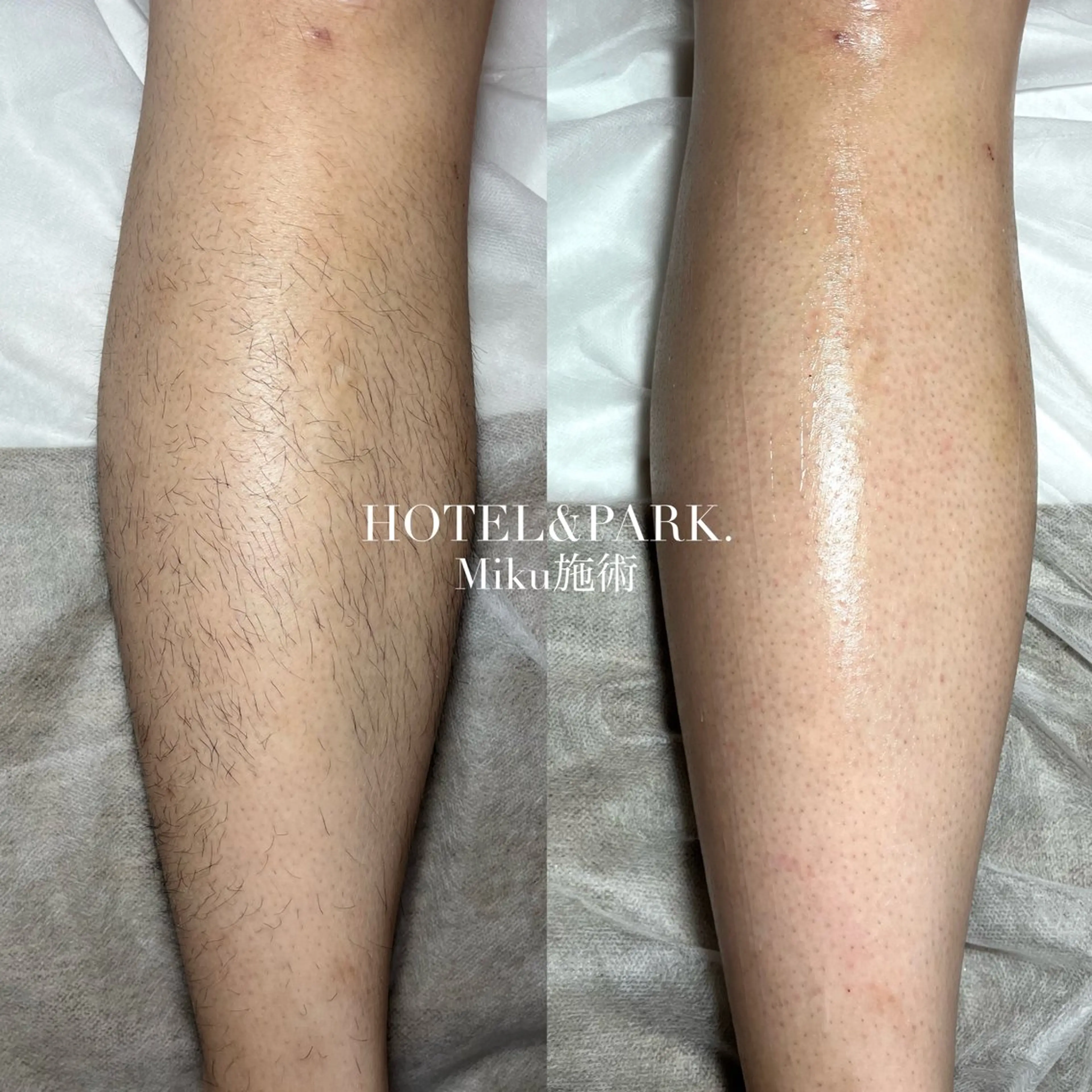 HOTEL&PARK Mikuワックス脱毛のエステ・リラクイメージ