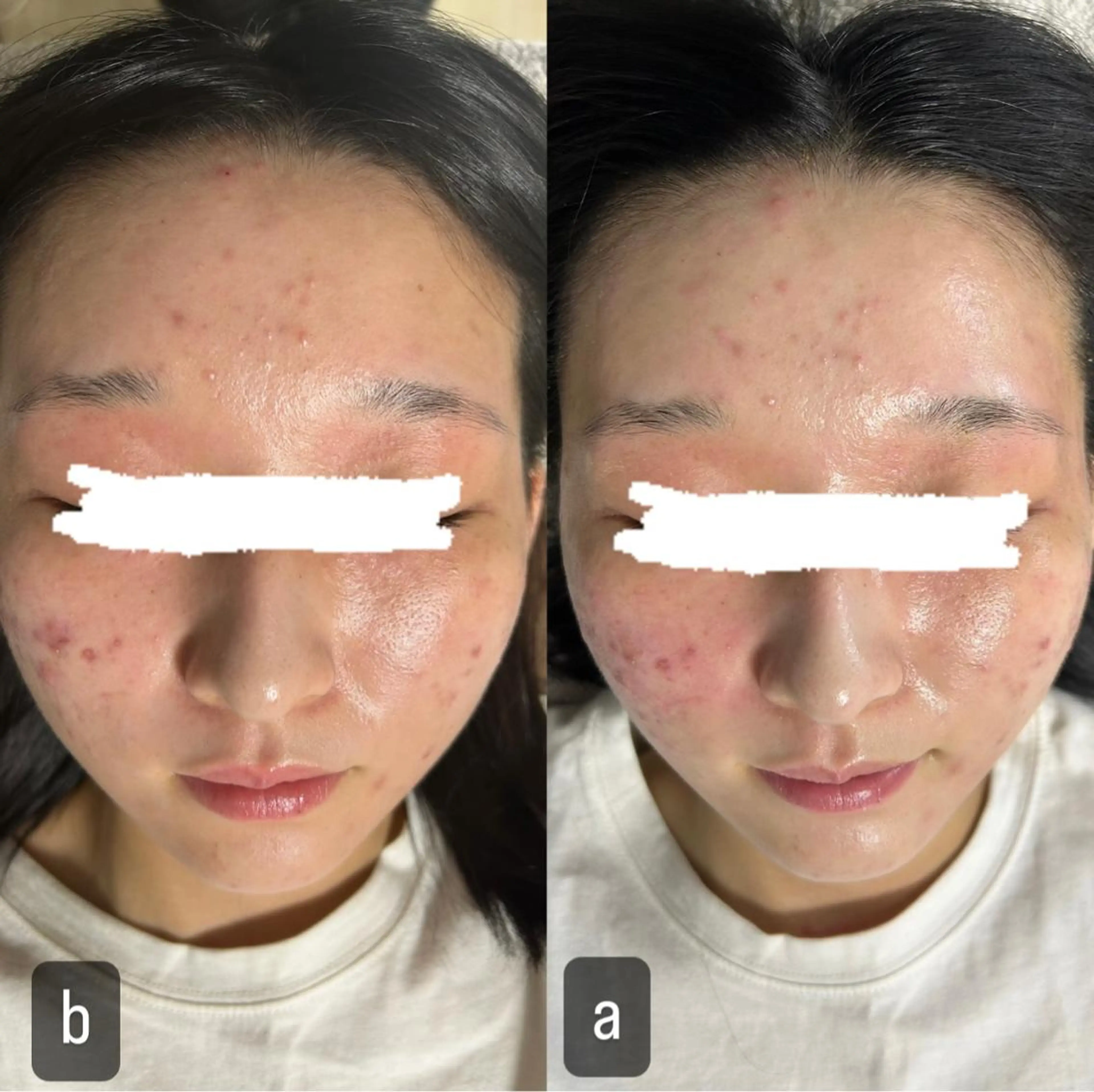 217 ホワイトニングルームのエステ・リラクイメージ