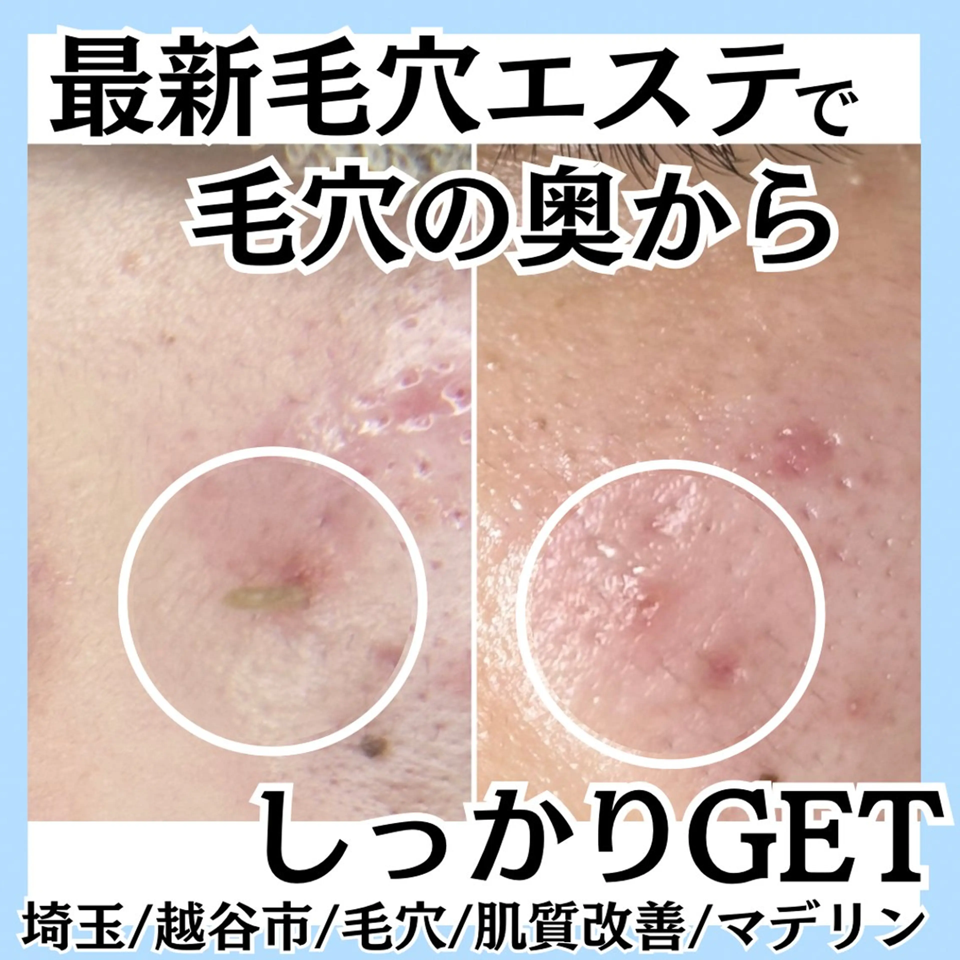 脱毛MAX 代表 まなみのエステ・リラクイメージ