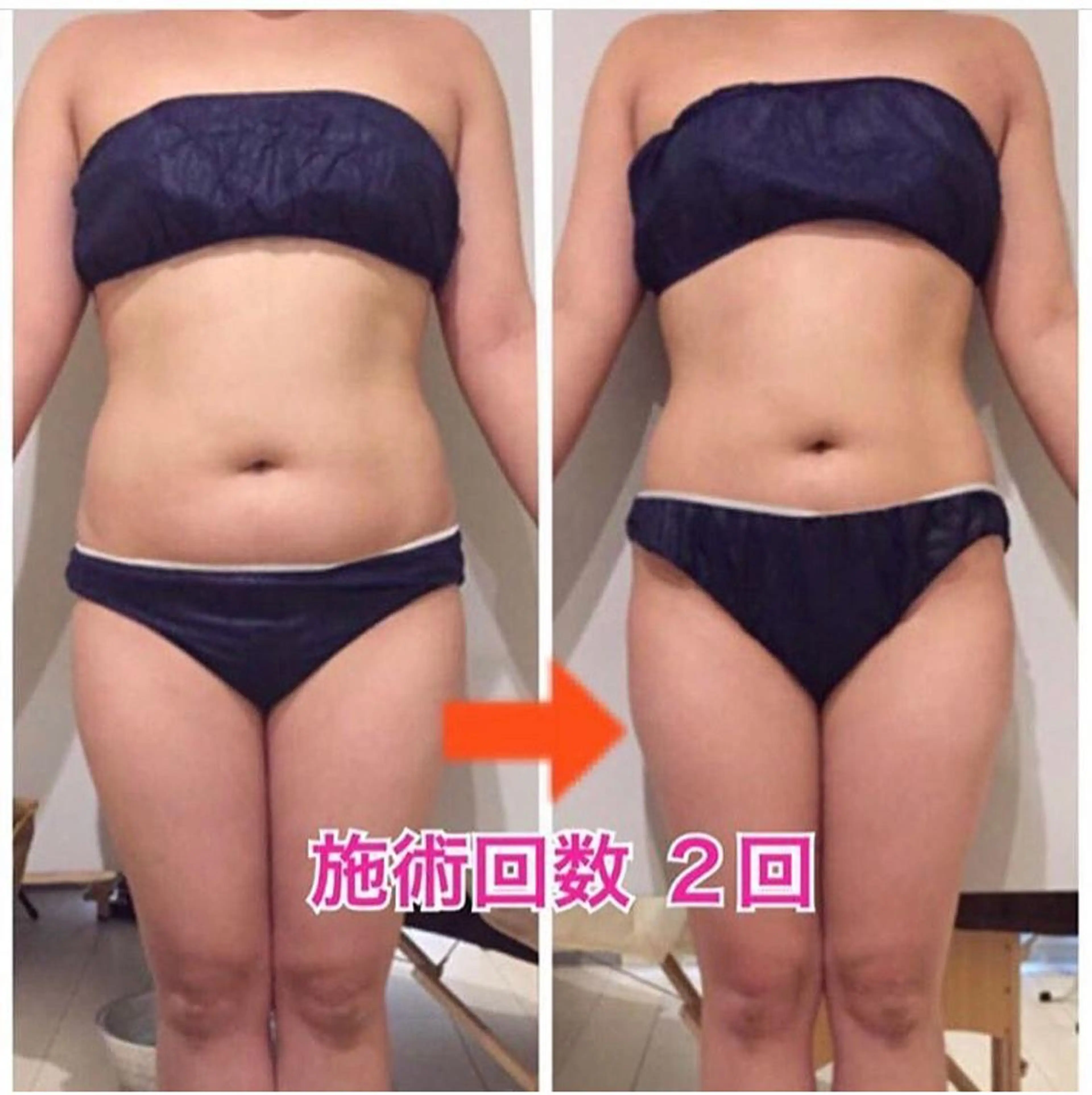 カラー パーマ ヘアアレンジ メンズ キッズ ネイル マツエク・マツパ 痩身&ボディ 結果出し🌟丹野のエステ・リラクイメージ