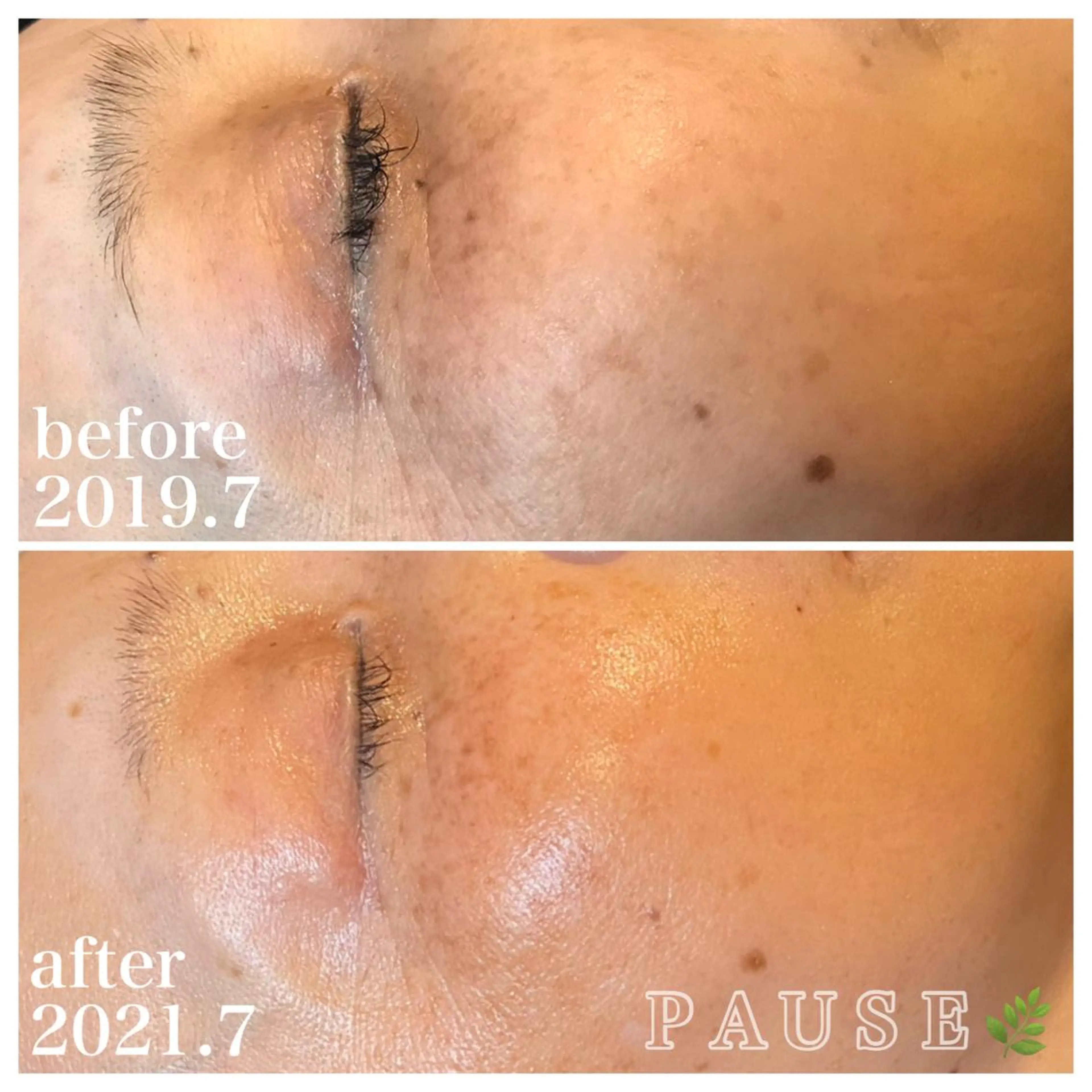 エステ 浜野 恵美のエステ・リラクイメージ